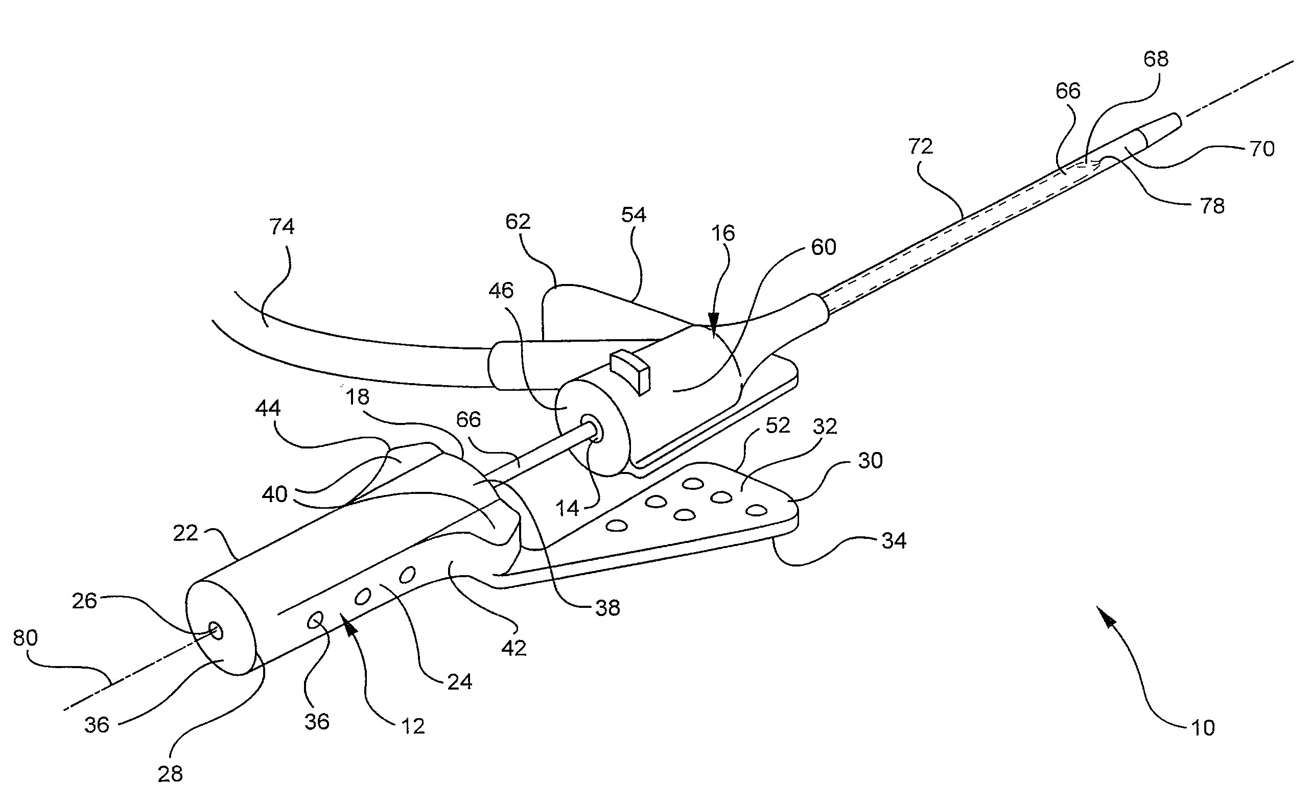 Systems and methods for providing a conventional integrated catheter with universal grip