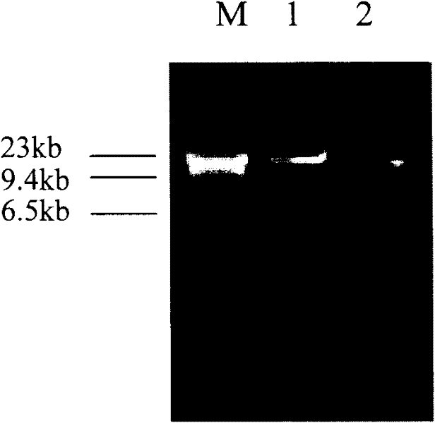 Kit and method for extracting microbial DNA