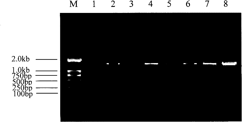 Kit and method for extracting microbial DNA