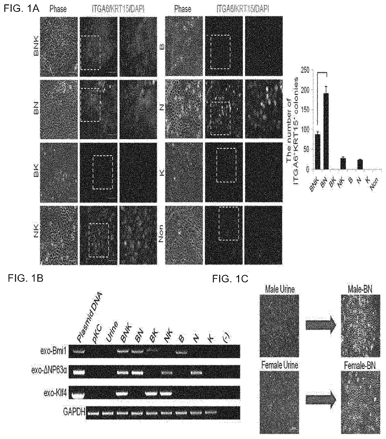 Method for direct reprogramming of urine cells into keratinocyte stem cells and method for preparing composition for promoting skin regeneration using reprogrammed keratinocyte stem cells