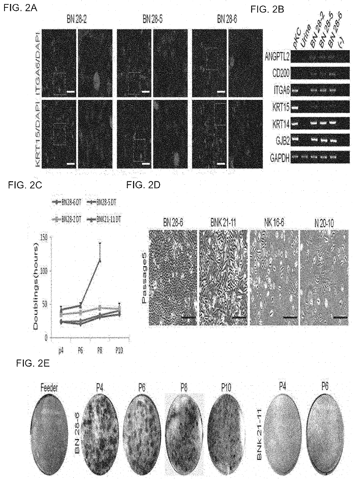 Method for direct reprogramming of urine cells into keratinocyte stem cells and method for preparing composition for promoting skin regeneration using reprogrammed keratinocyte stem cells