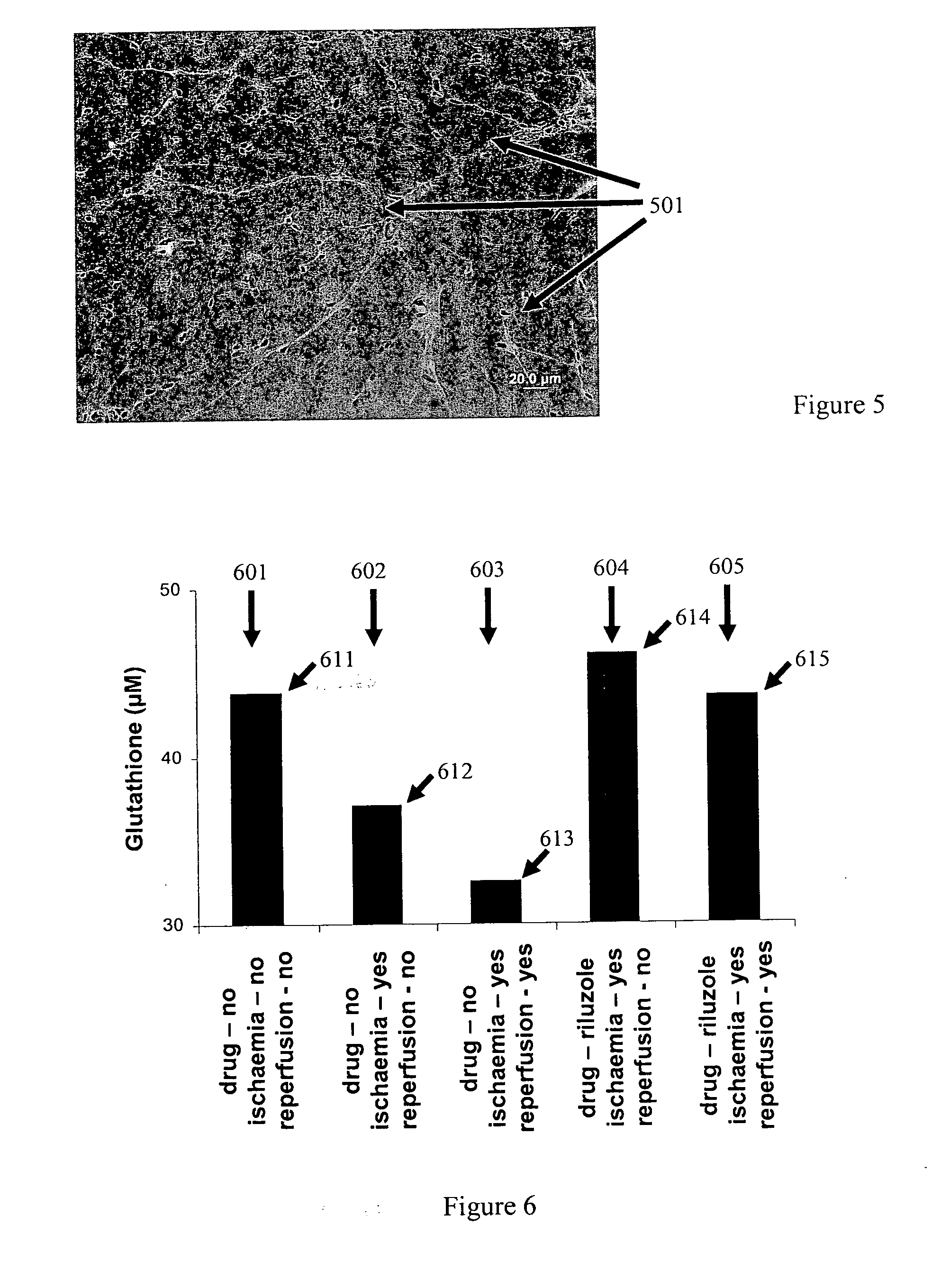 Treatment of non-neuronal and non-myocardial cell, tissue and organ damage and associated pain with persistent sodium current blockers