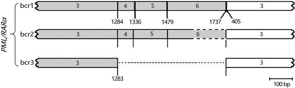 Detection kit and detection method for APL drug resistance gene mutation