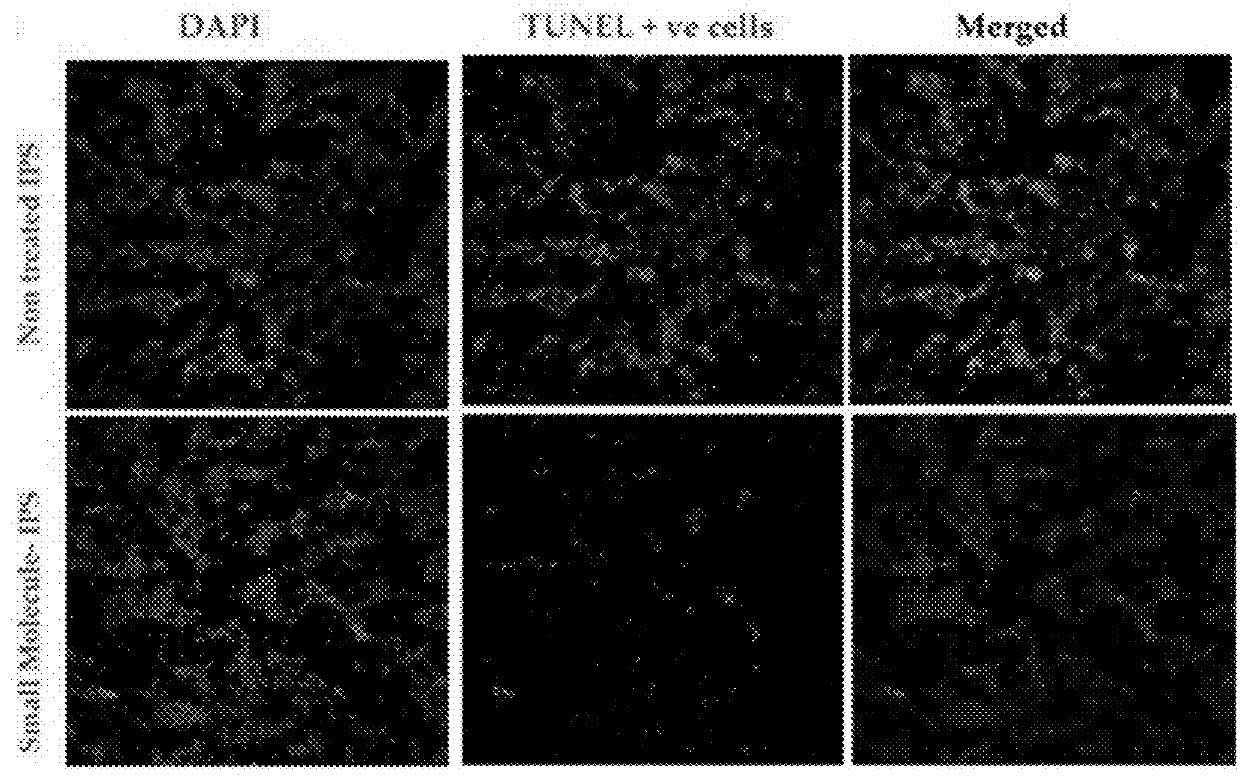 Microvesicle and stem cell compositions for therapeutic applications