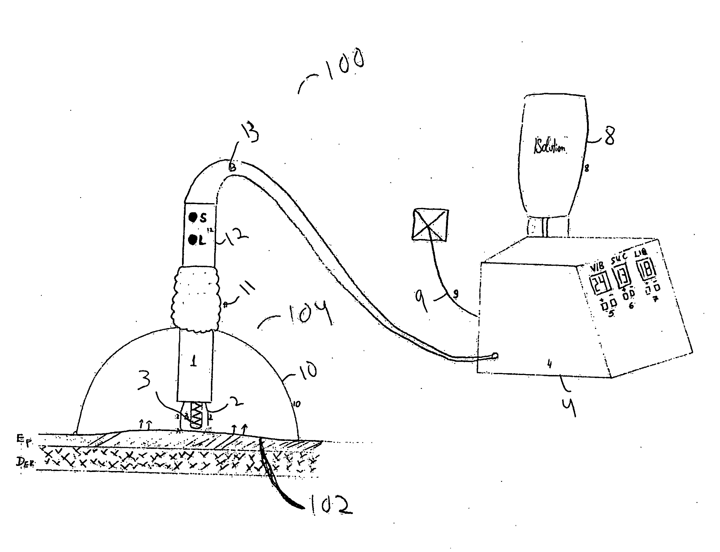 Device and system for skin treatment