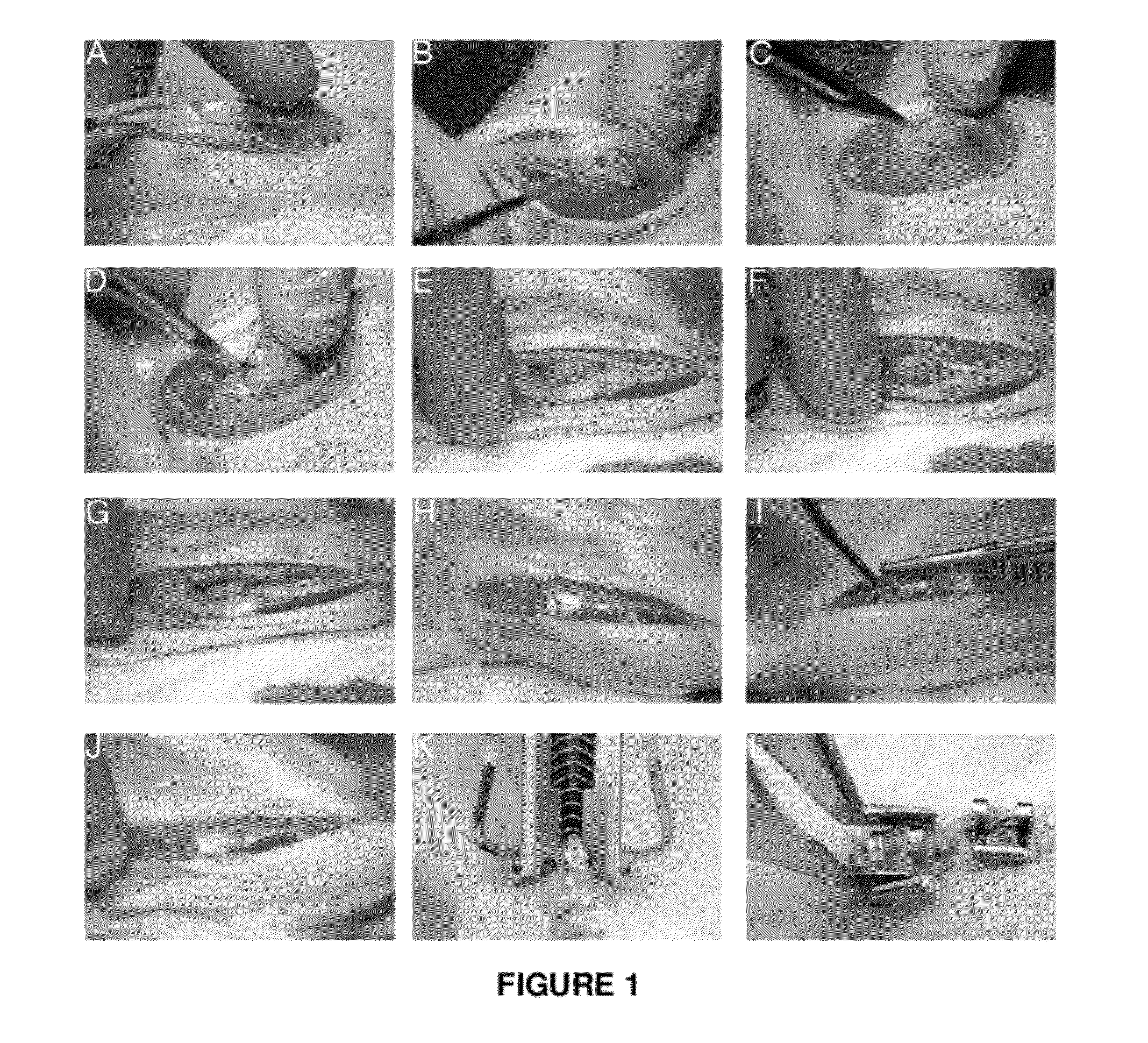 Dual antagonism of endothelin type a and bradykinin b1 receptors for treating pain and preventing cartilage degradation