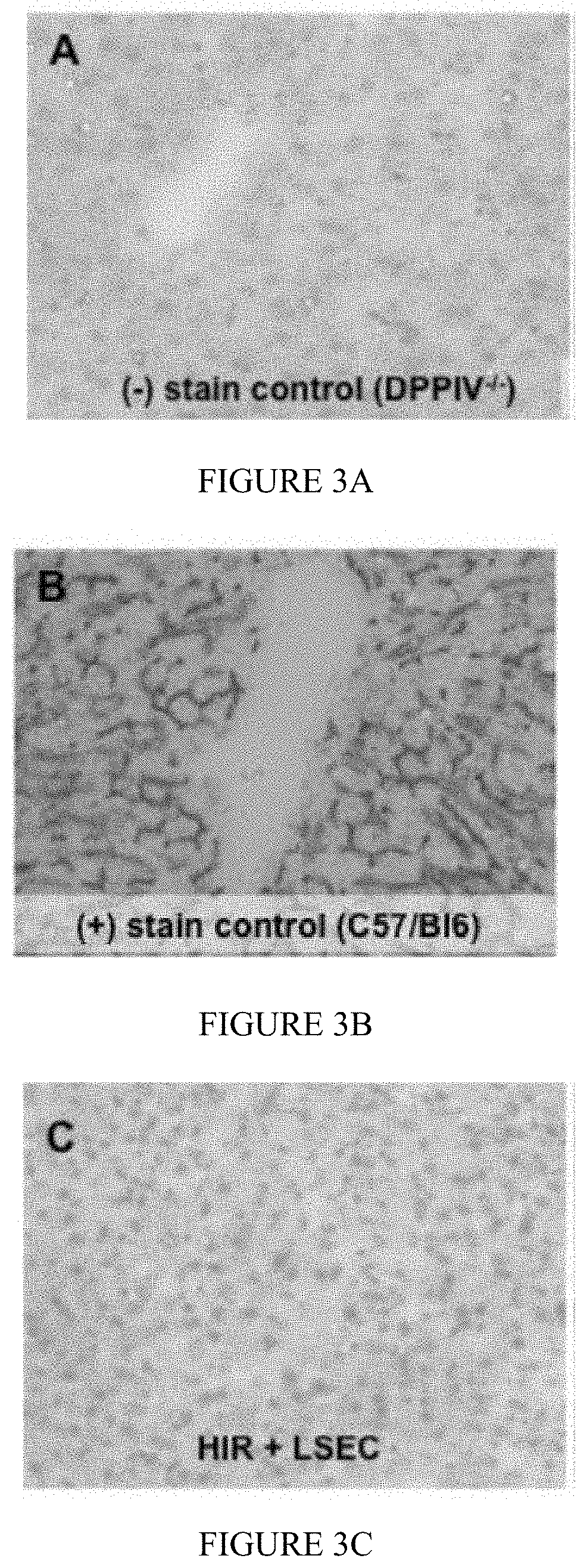 Methods for mitigating liver injury and promoting liver hypertrophy, regeneration and cell engraftment in conjunction with radiation and/or radiomimetic treatments