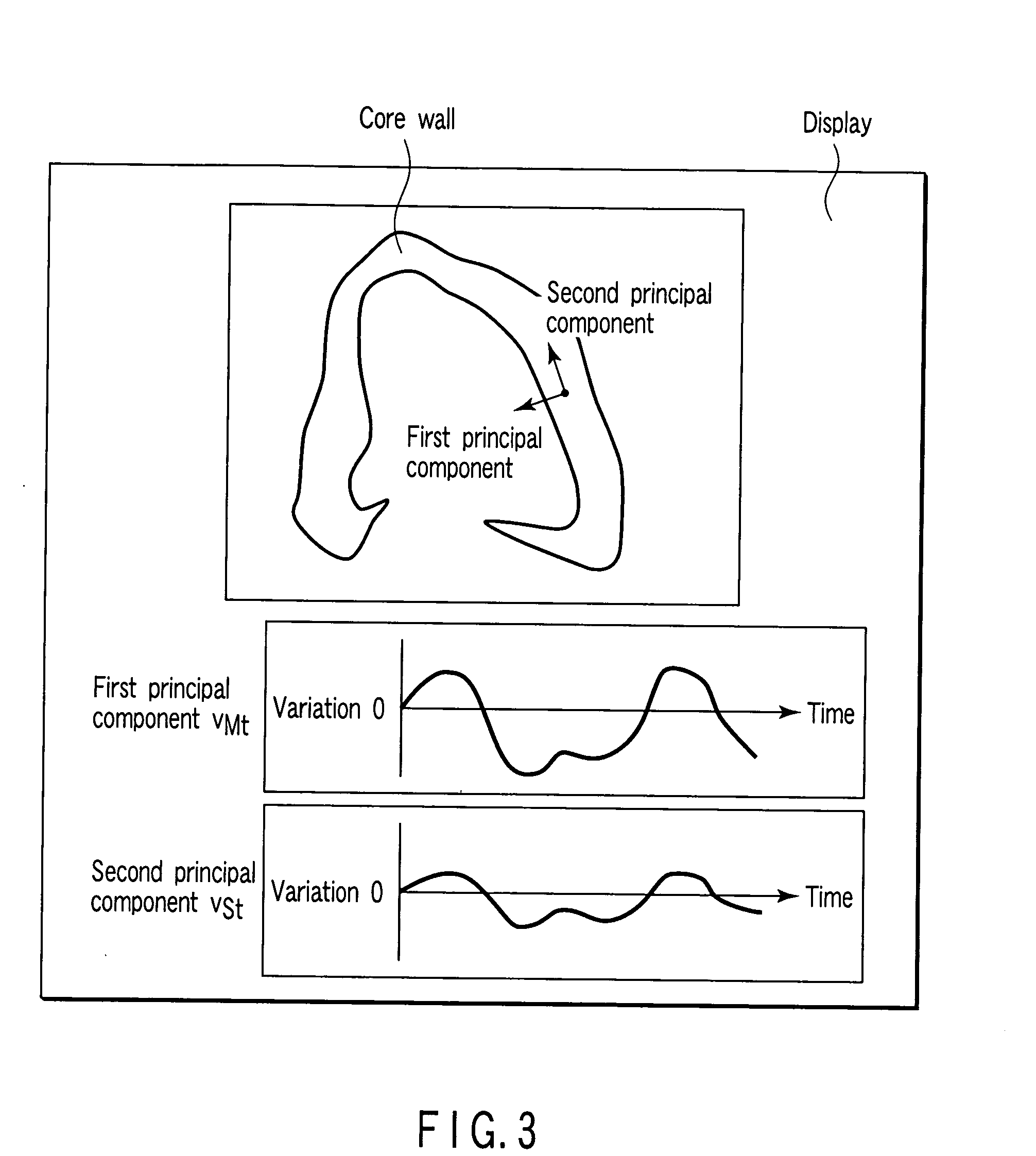 Medical kinematic analysis apparatus and a medical kinematic analysis method