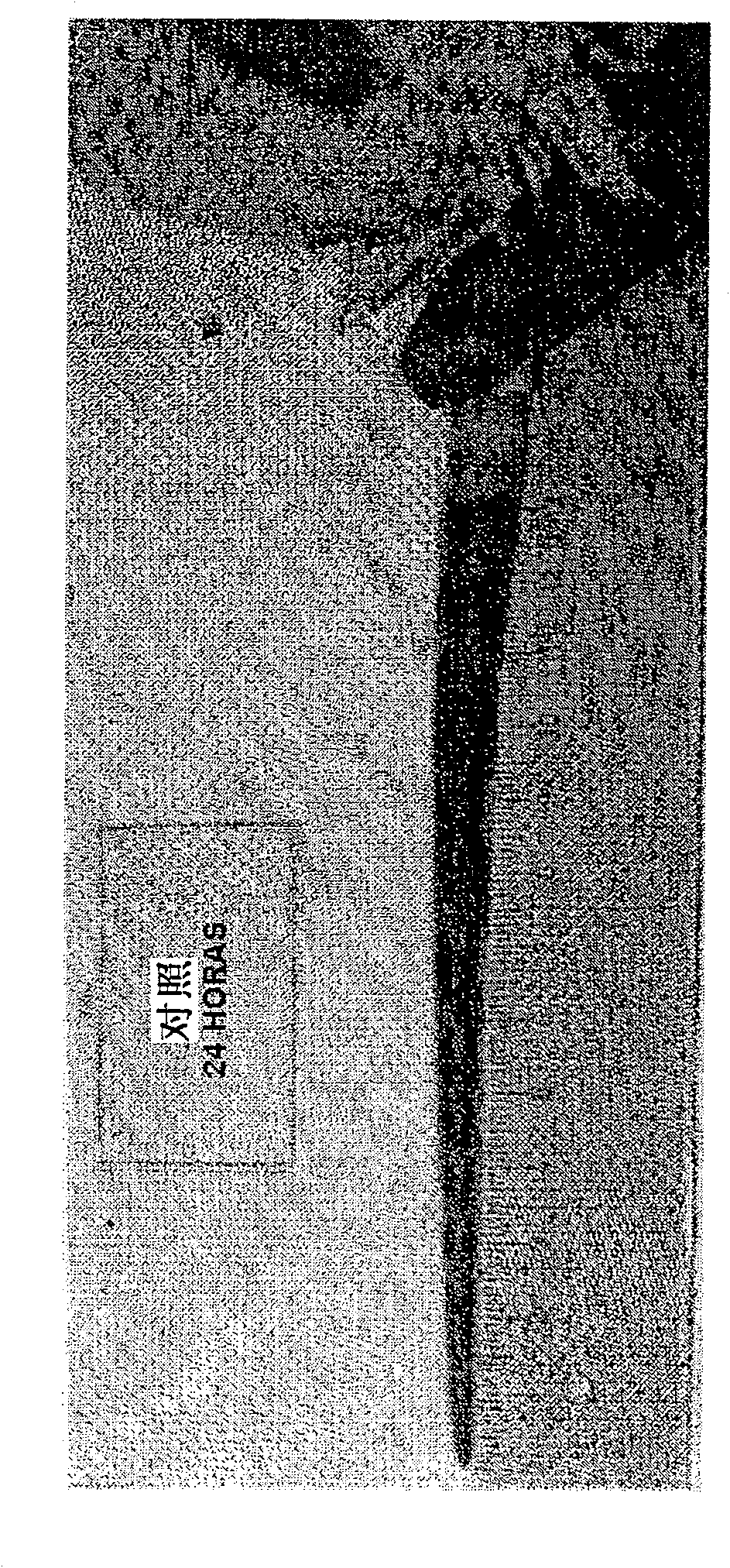 Low molecular weight heparin triethanolamine salt usable as local delivery antithrombotic treating agent, preparing process and use thereof