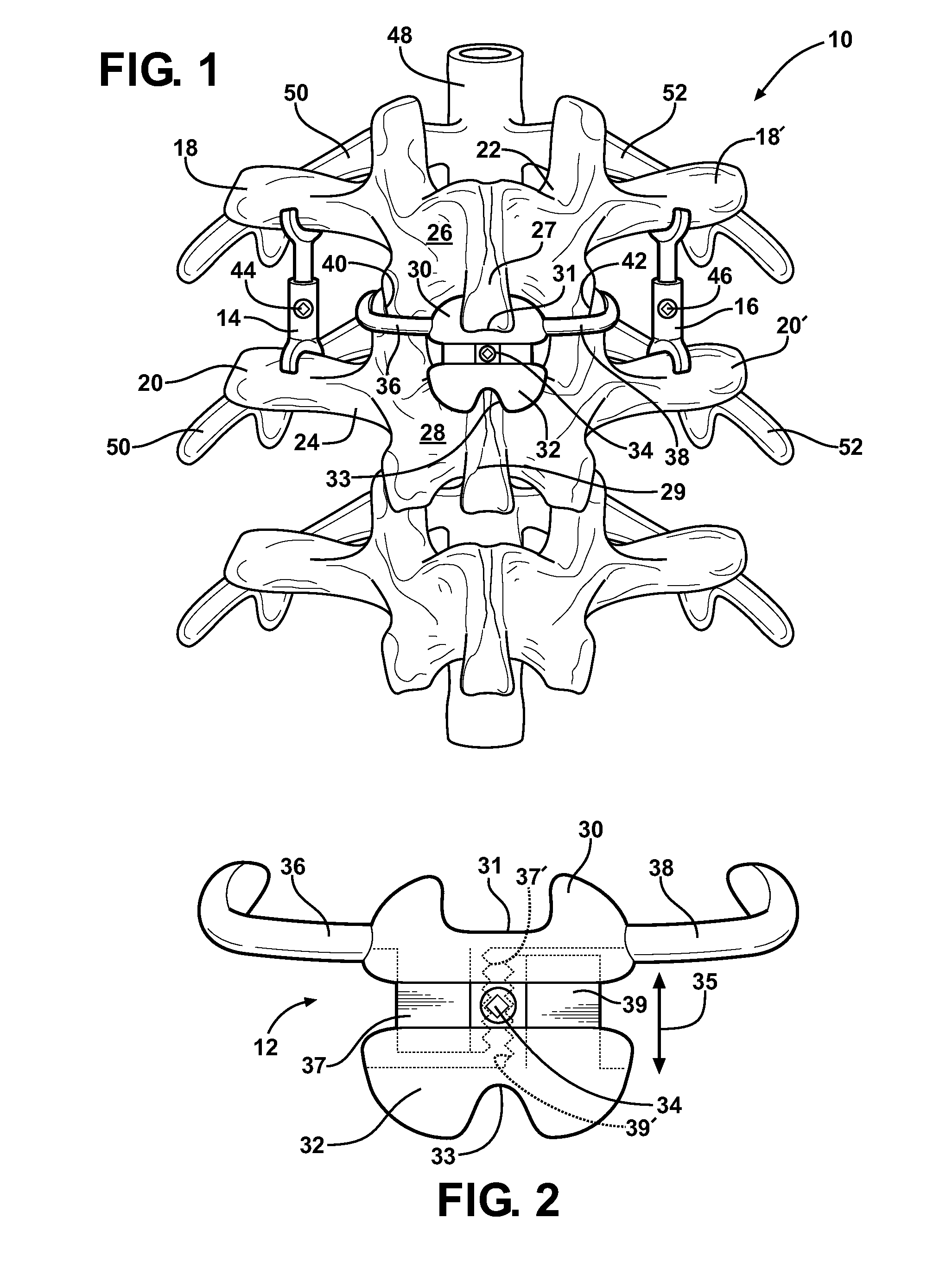 Support insert associated with spinal vertebrae