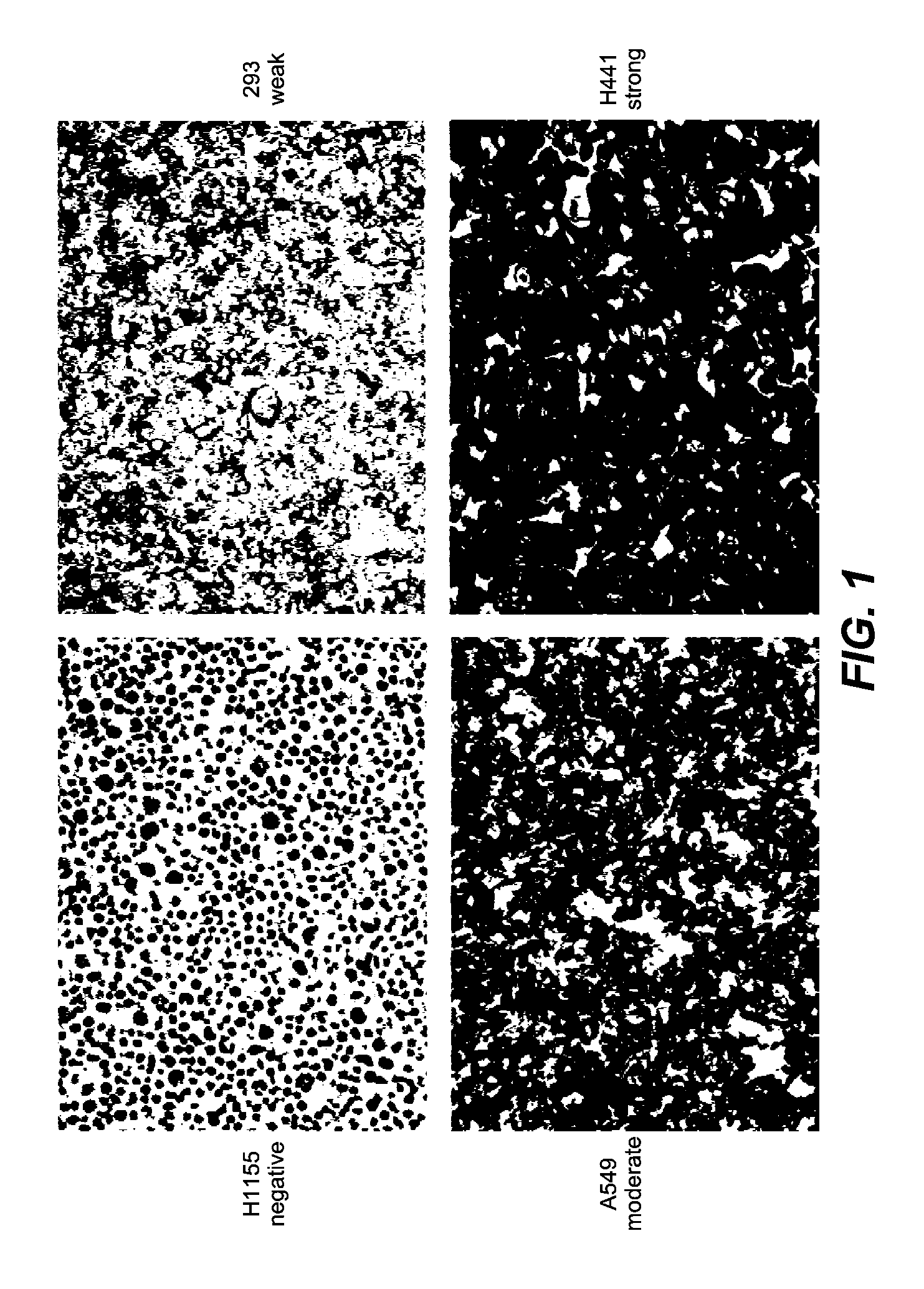 Biomarkers and methods of treatment