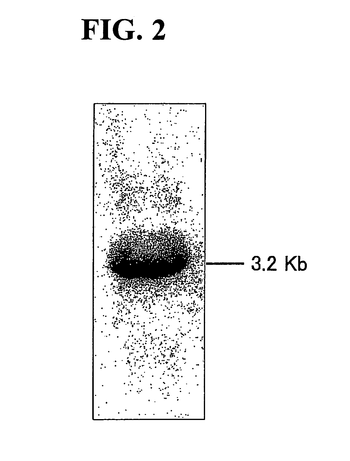 Polypeptide having Δ5 desaturating activity, polynucleotide coding for the polypeptide, and use thereof