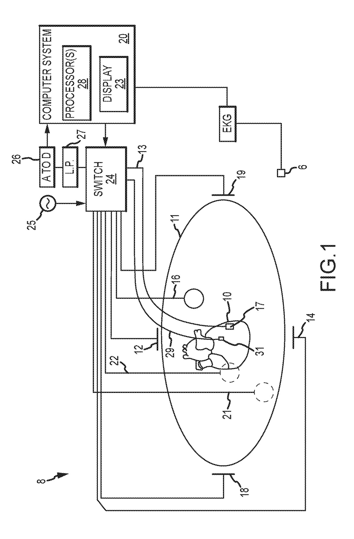 System and Method for Analyzing Biological Signals and Generating Electrophysiology Maps