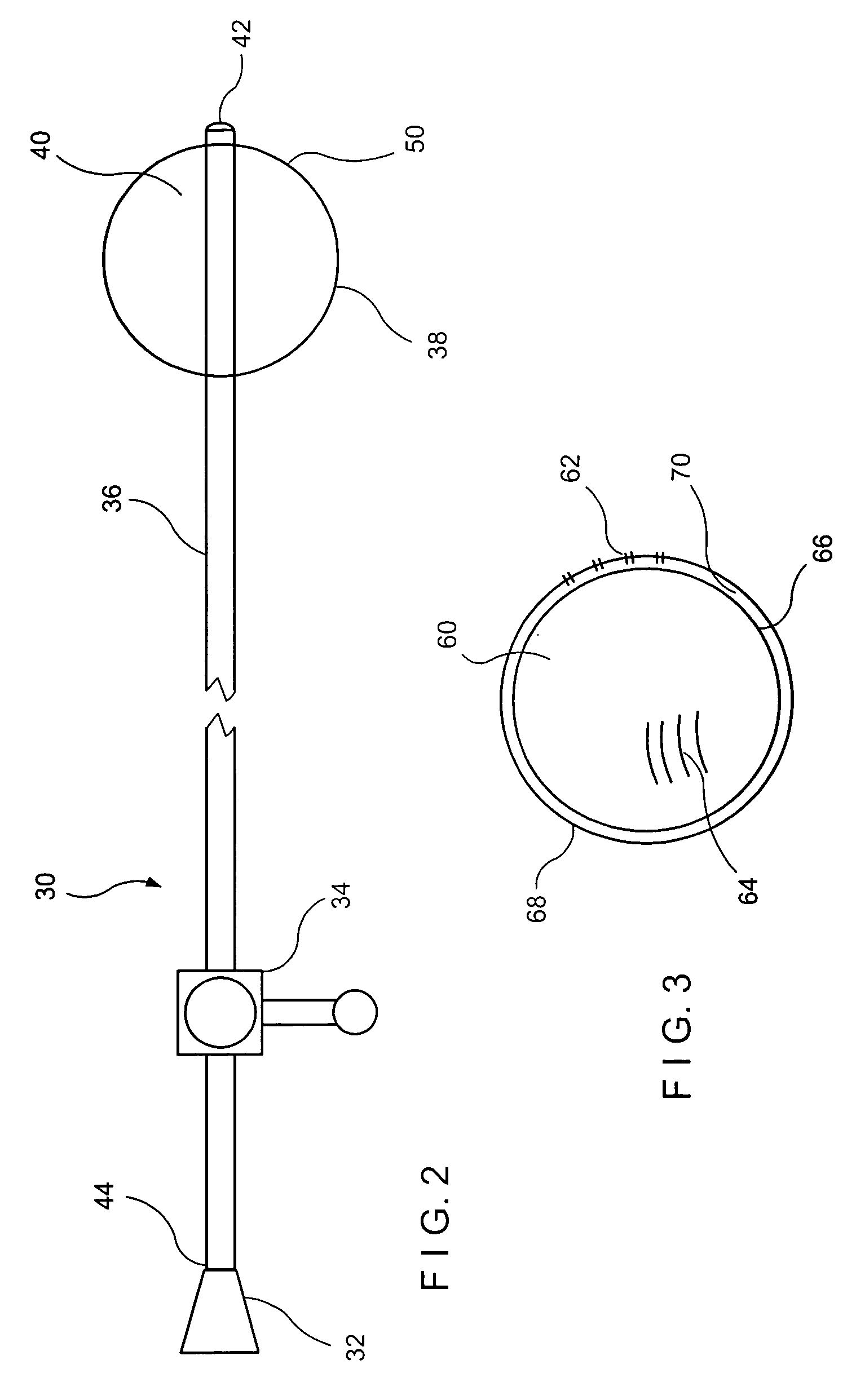 Temporary tissue spacer and pretreatment balloon