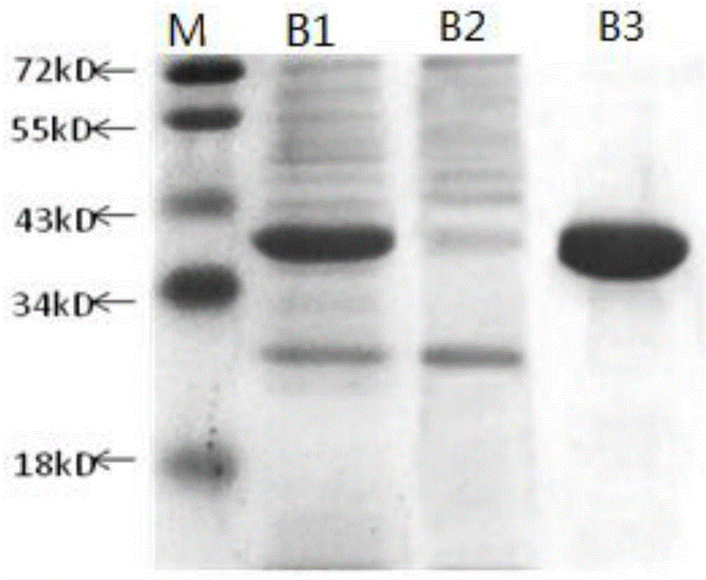 Human Annexin V genetic optimization sequence and preparation method and application thereof