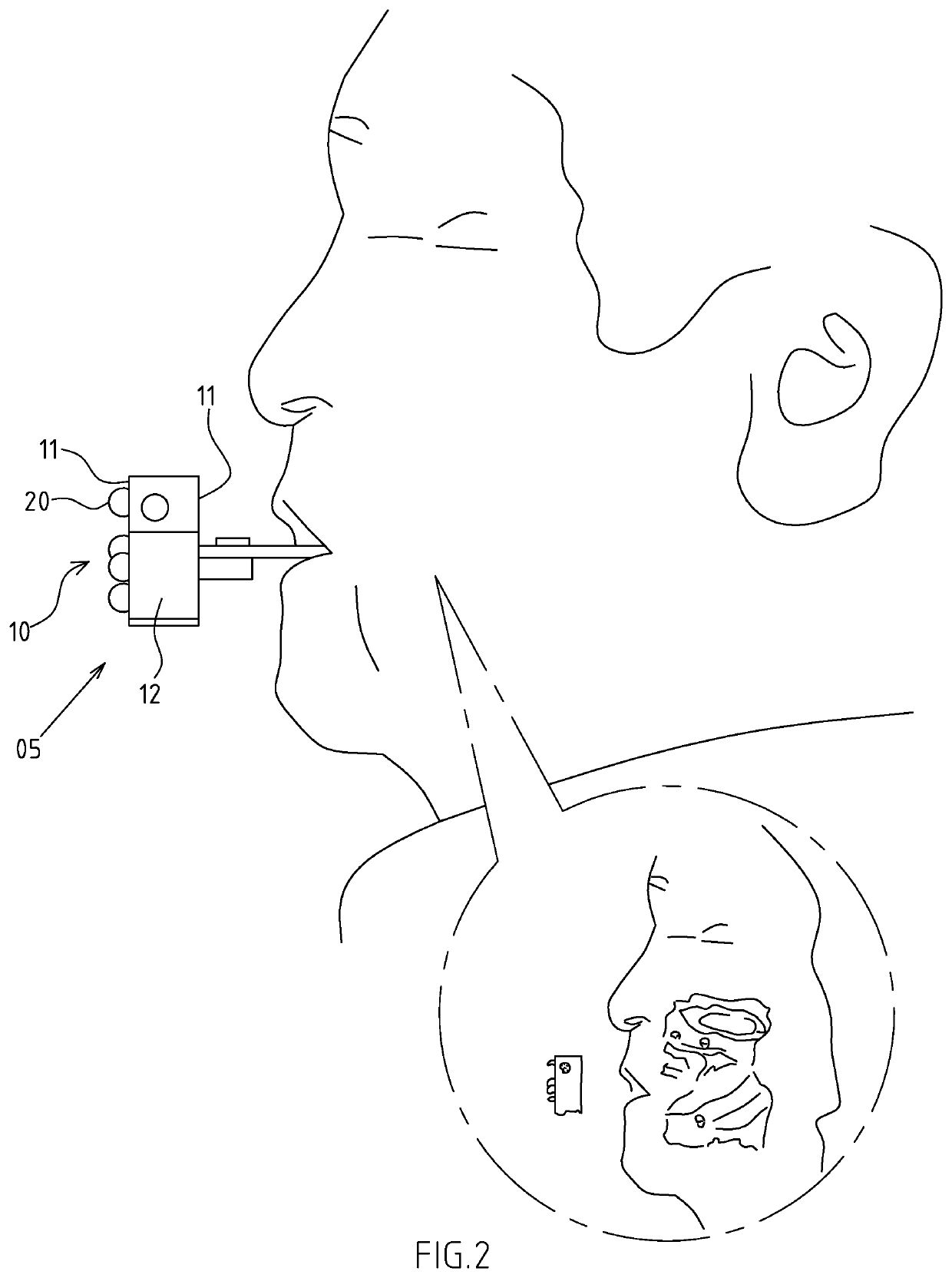Face scanning and positioning structure used for full denture