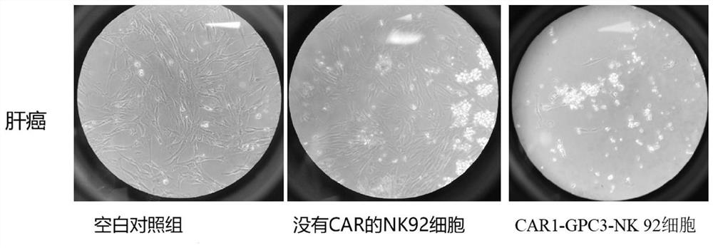 GPC3-targeted CAR and CAR-NK cell using same