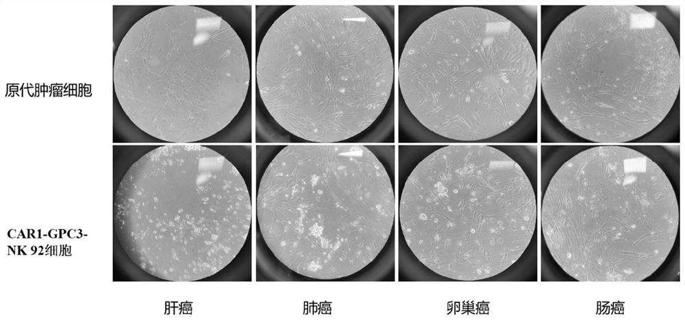 GPC3-targeted CAR and CAR-NK cell using same