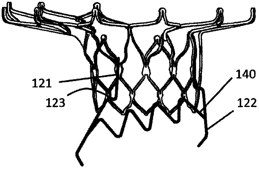 A prosthetic valve prosthesis with an anchor