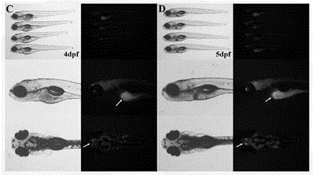 Transgene zebra fish system with abcb4 and establishing method thereof