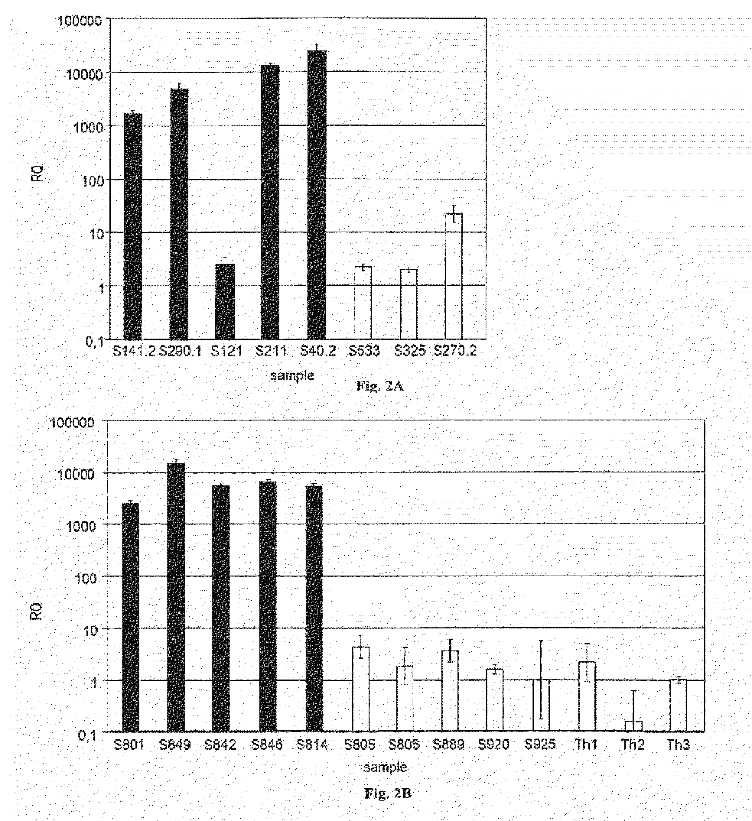Microrna-based methods and compositions for the diagnosis, prognosis and treatment of tumor involving chromosomal rearrangements