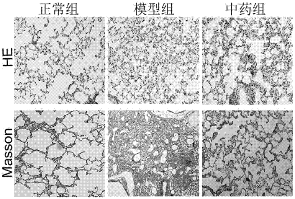 Traditional Chinese medicine composition and application thereof to preparation of drugs for treating pulmonary fibrosis diseases
