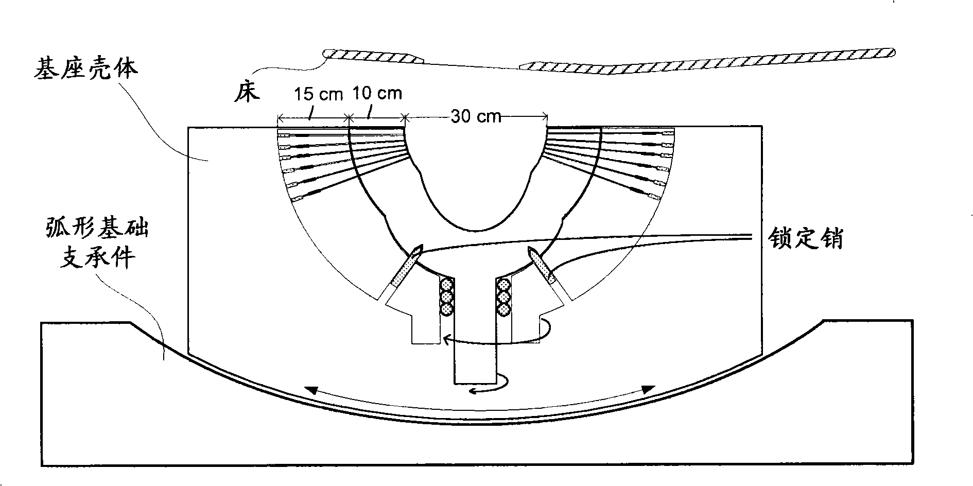 Method and equipment for image-guided stereotactic radiosurgery of breast cancer