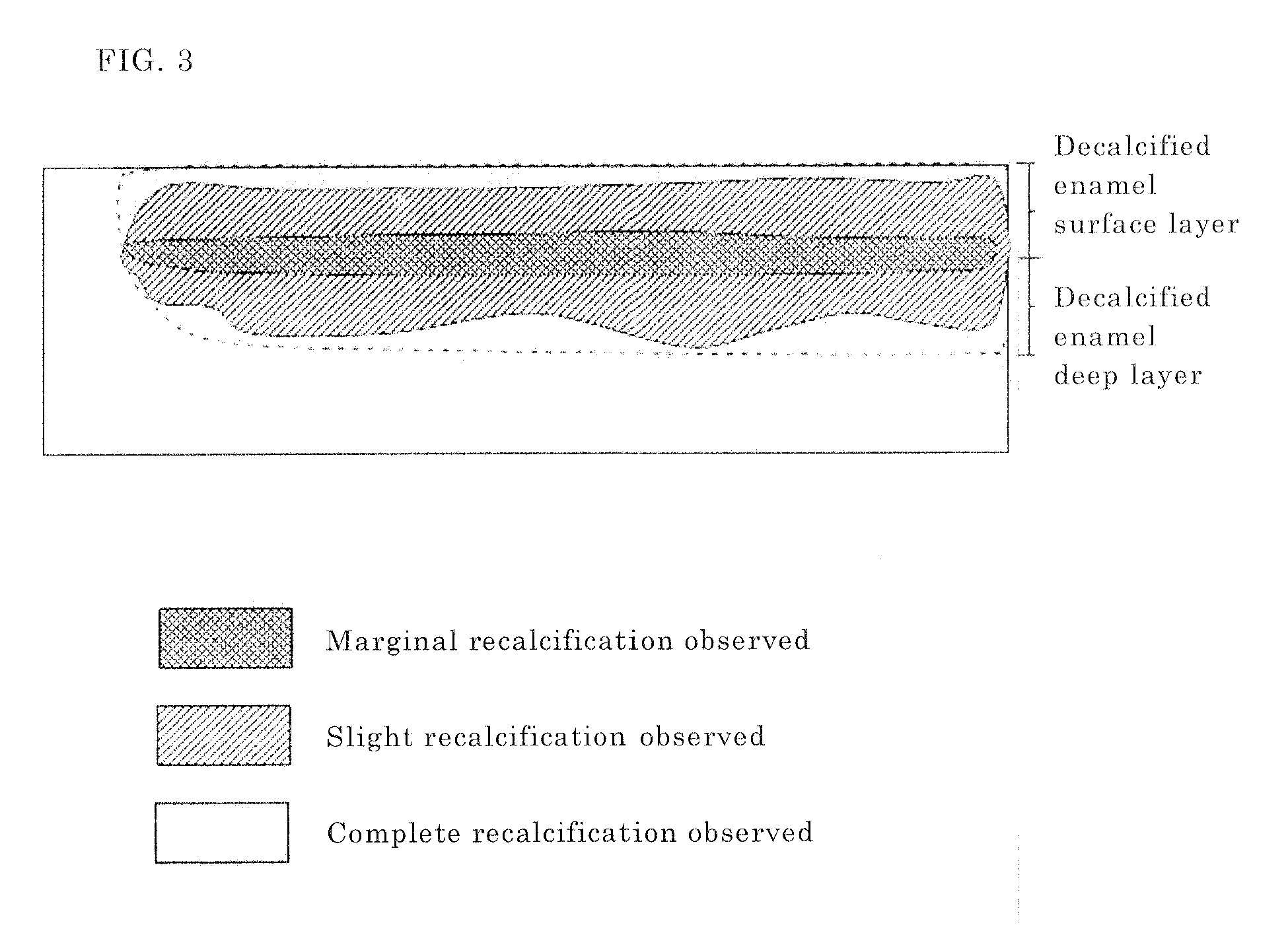 Dental enamel recalcification accelerator and containing the same, oral composition and food or beverage
