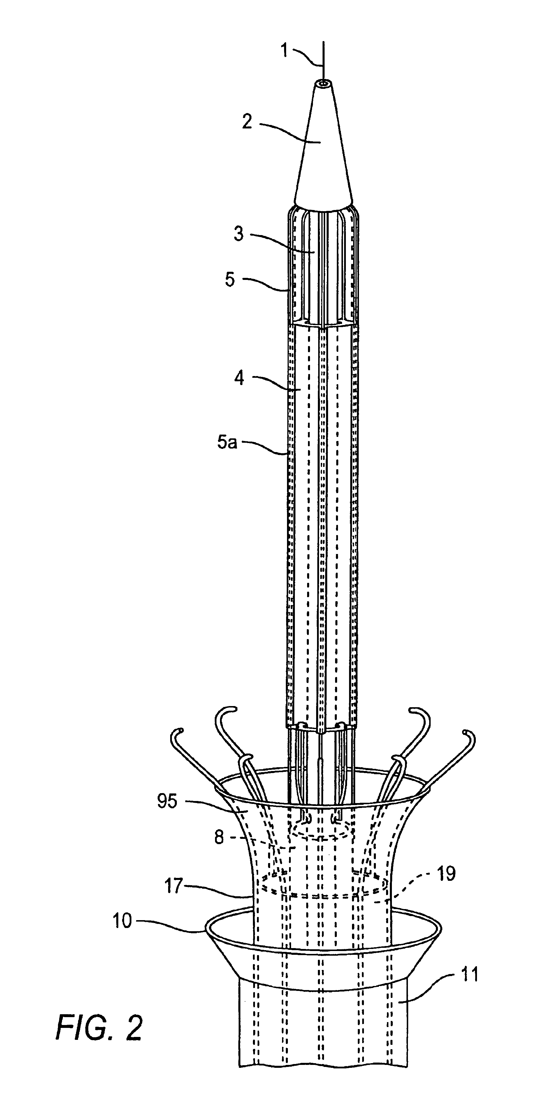 Methods for delivering, repositioning and/or retrieving self-expanding stents