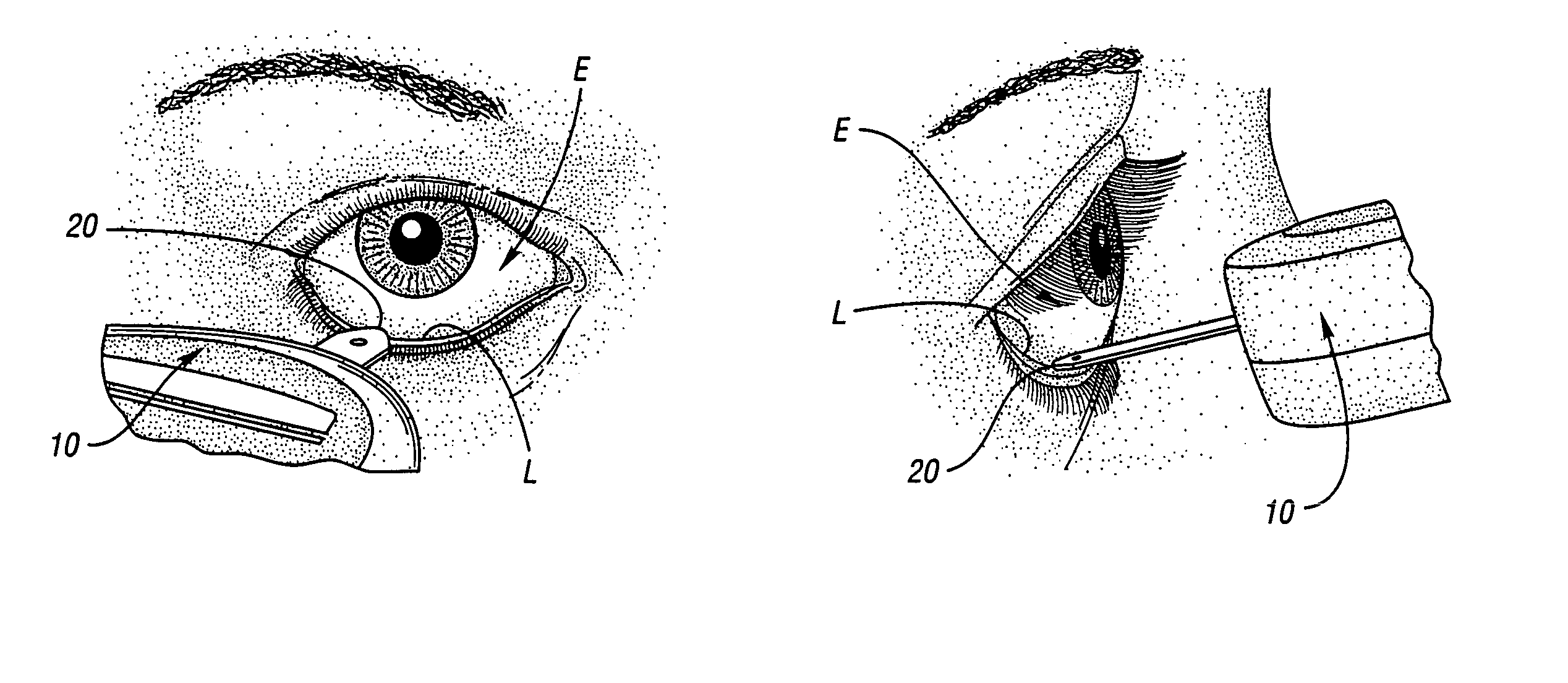 Method and apparatus for non-invasive monitoring of blood substances using self-sampled tears