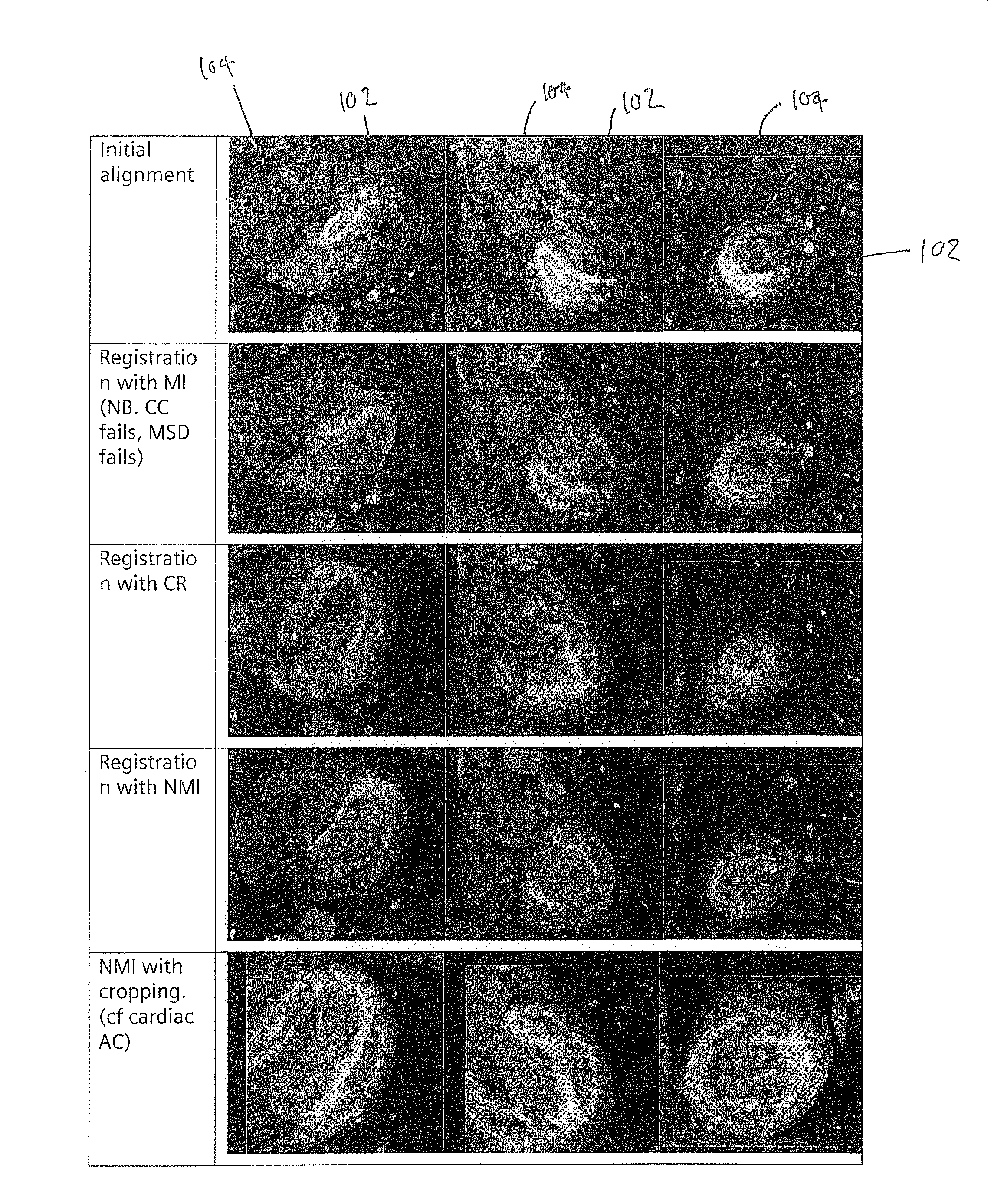 Methods and apparatus for aligning sets of medical imaging data