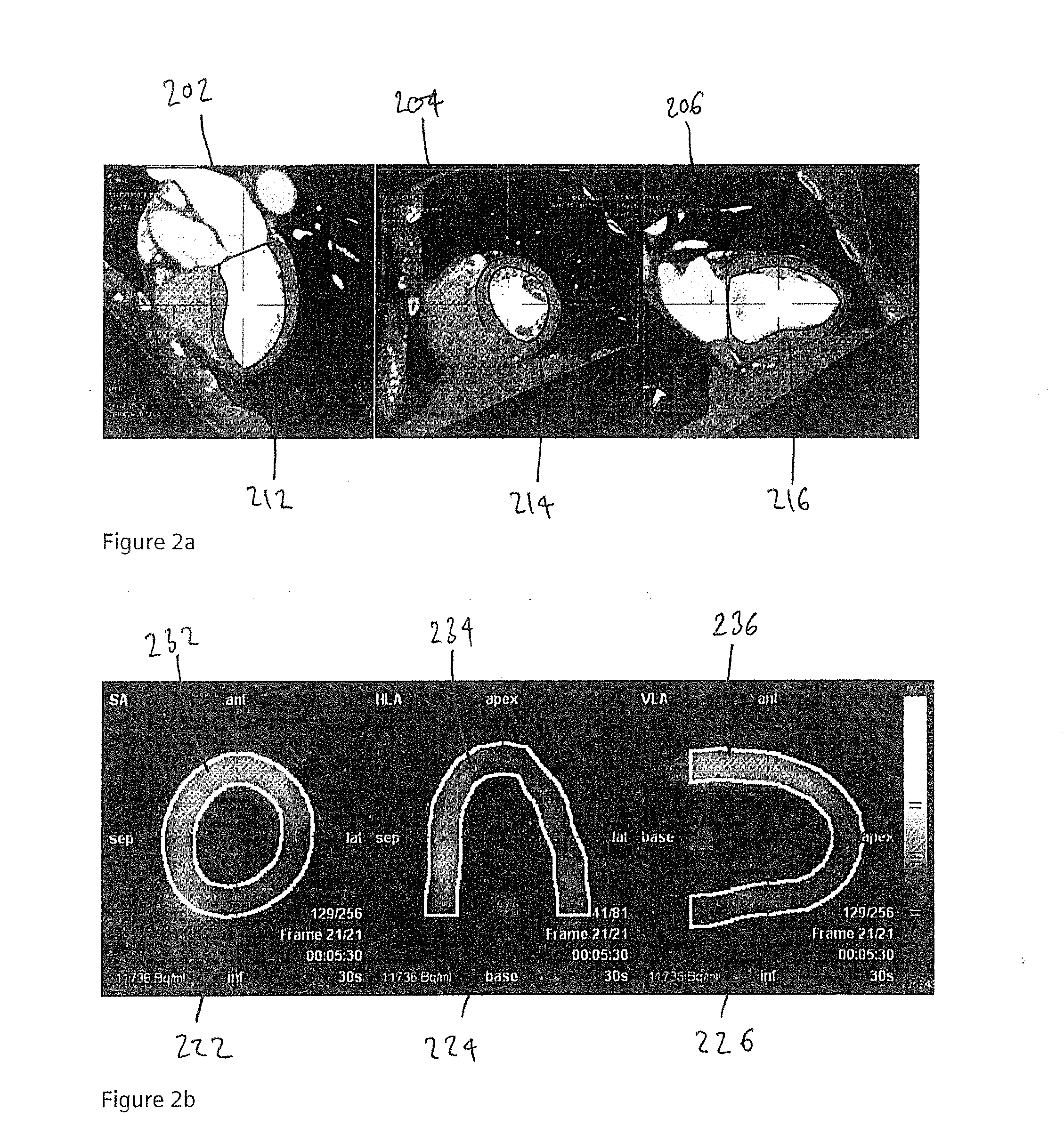 Methods and apparatus for aligning sets of medical imaging data