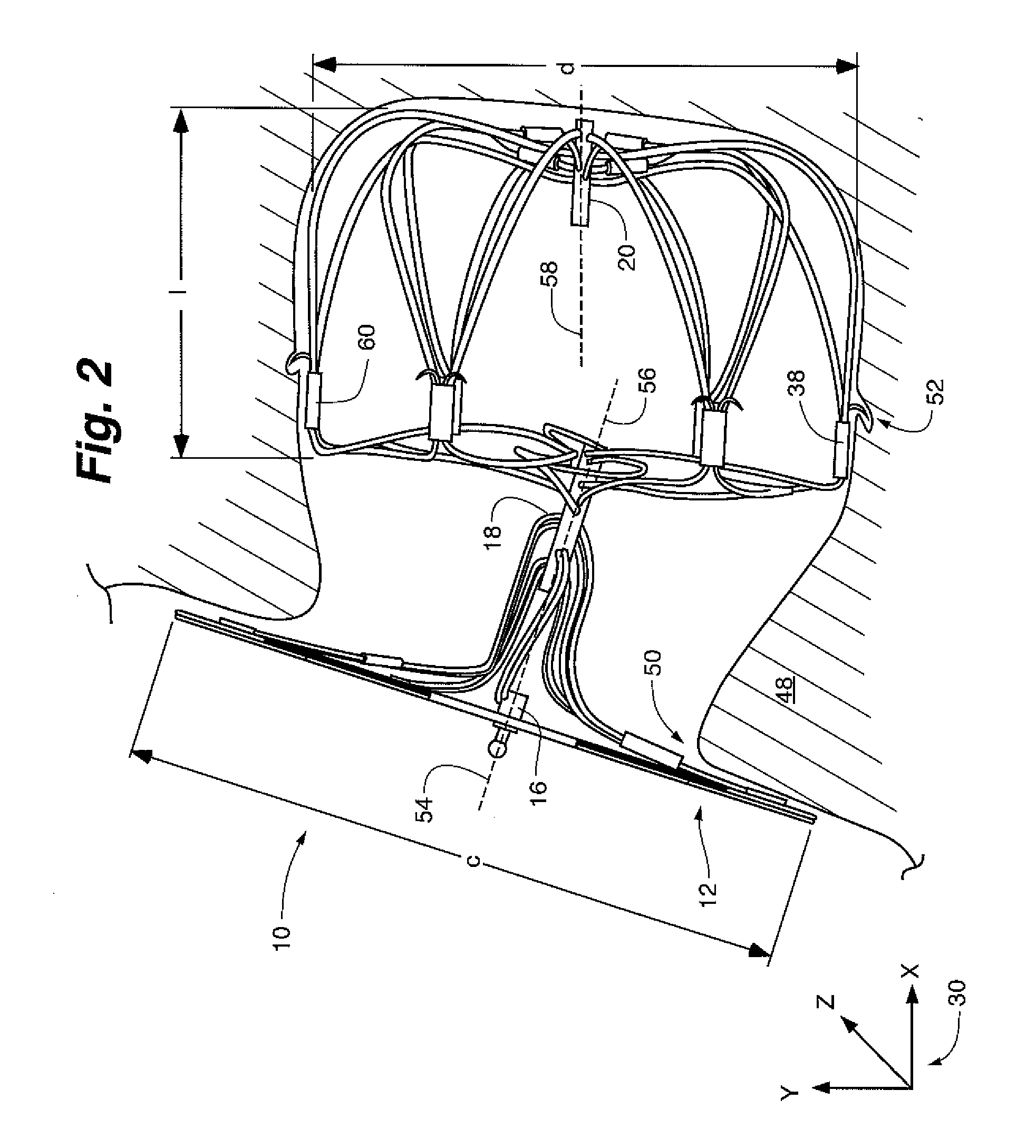 Redeployable left atrial appendage occlusion device