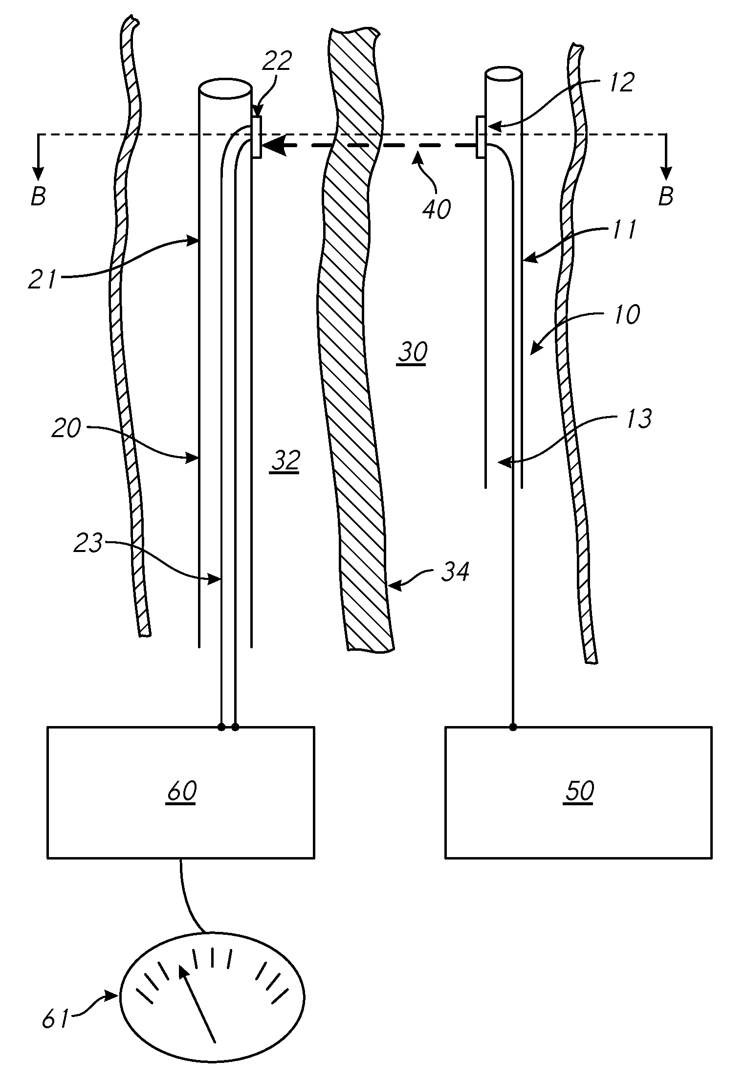 Methods and systems for providing or maintaining fluid flow through body passages