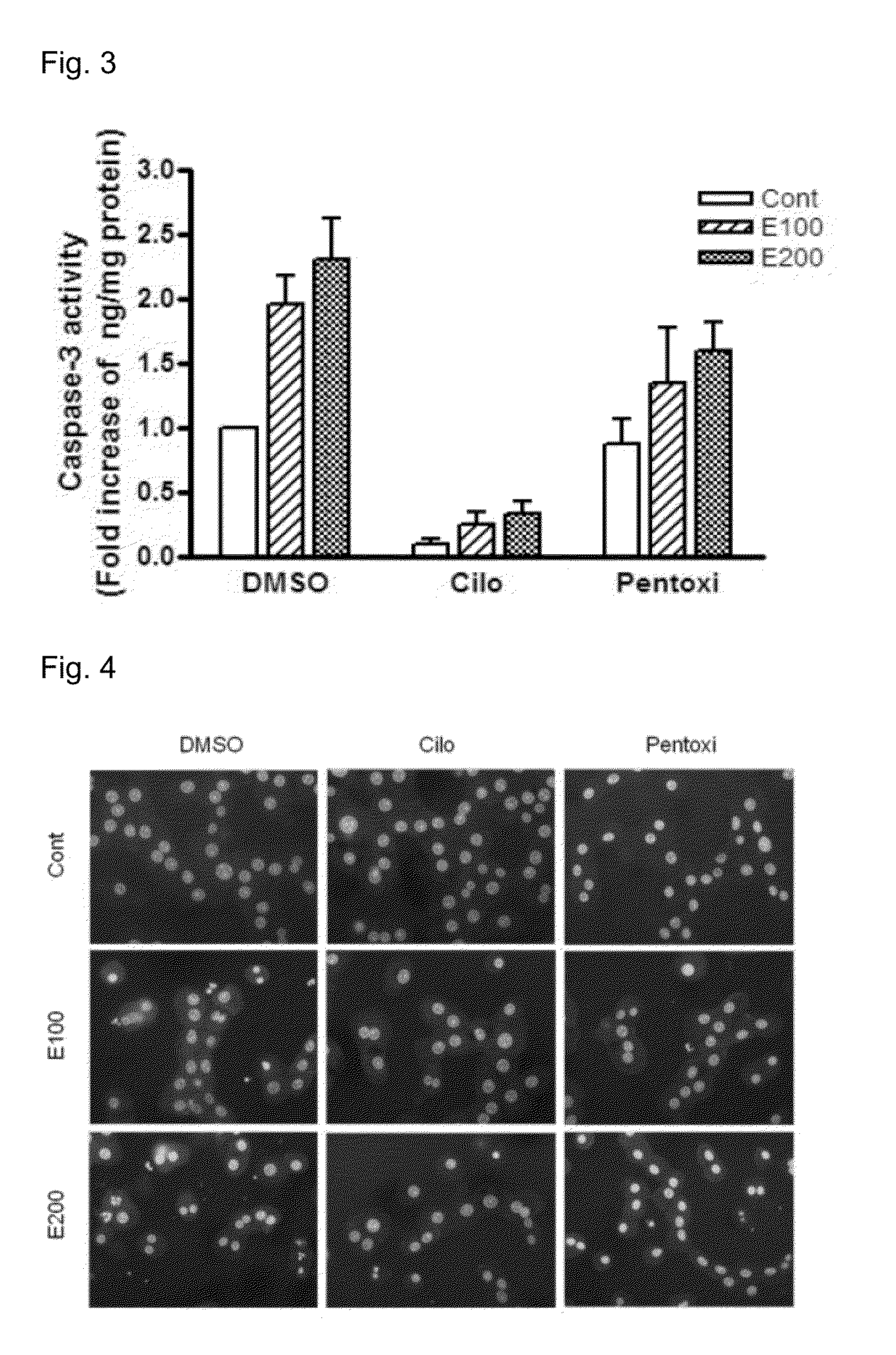 Pharmaceutical composition for treating or preventing alcoholic liver diseases, containing cilostazol as active ingredient
