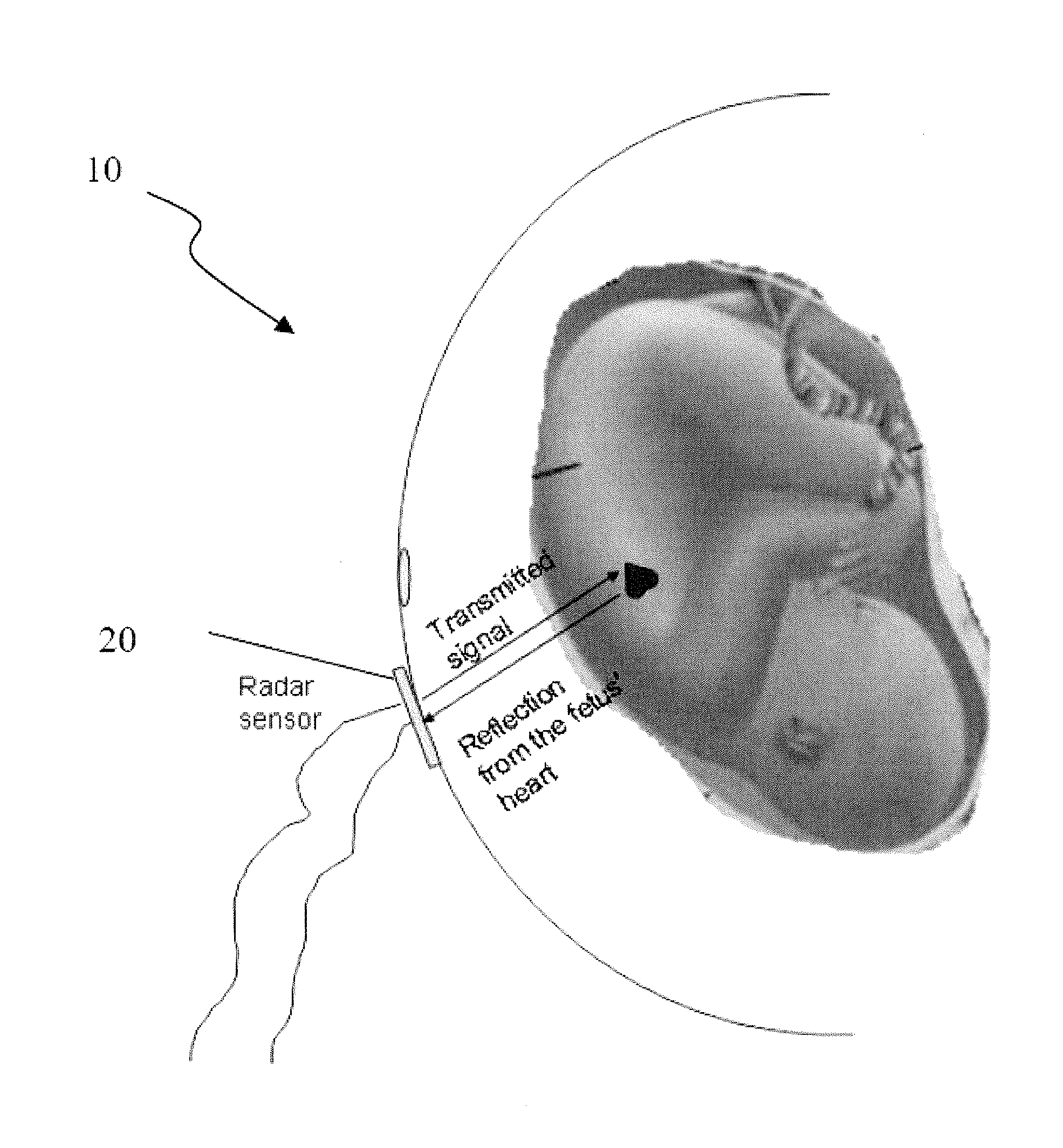 Fetal monitoring device and methods