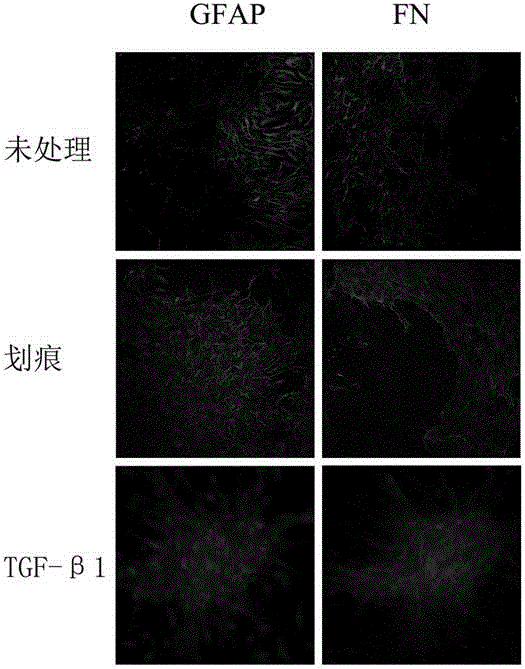 In-vitro glial scar forming model and establishment method and application thereof