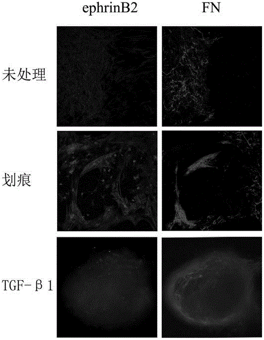 In-vitro glial scar forming model and establishment method and application thereof