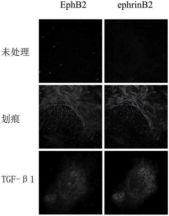 In-vitro glial scar forming model and establishment method and application thereof