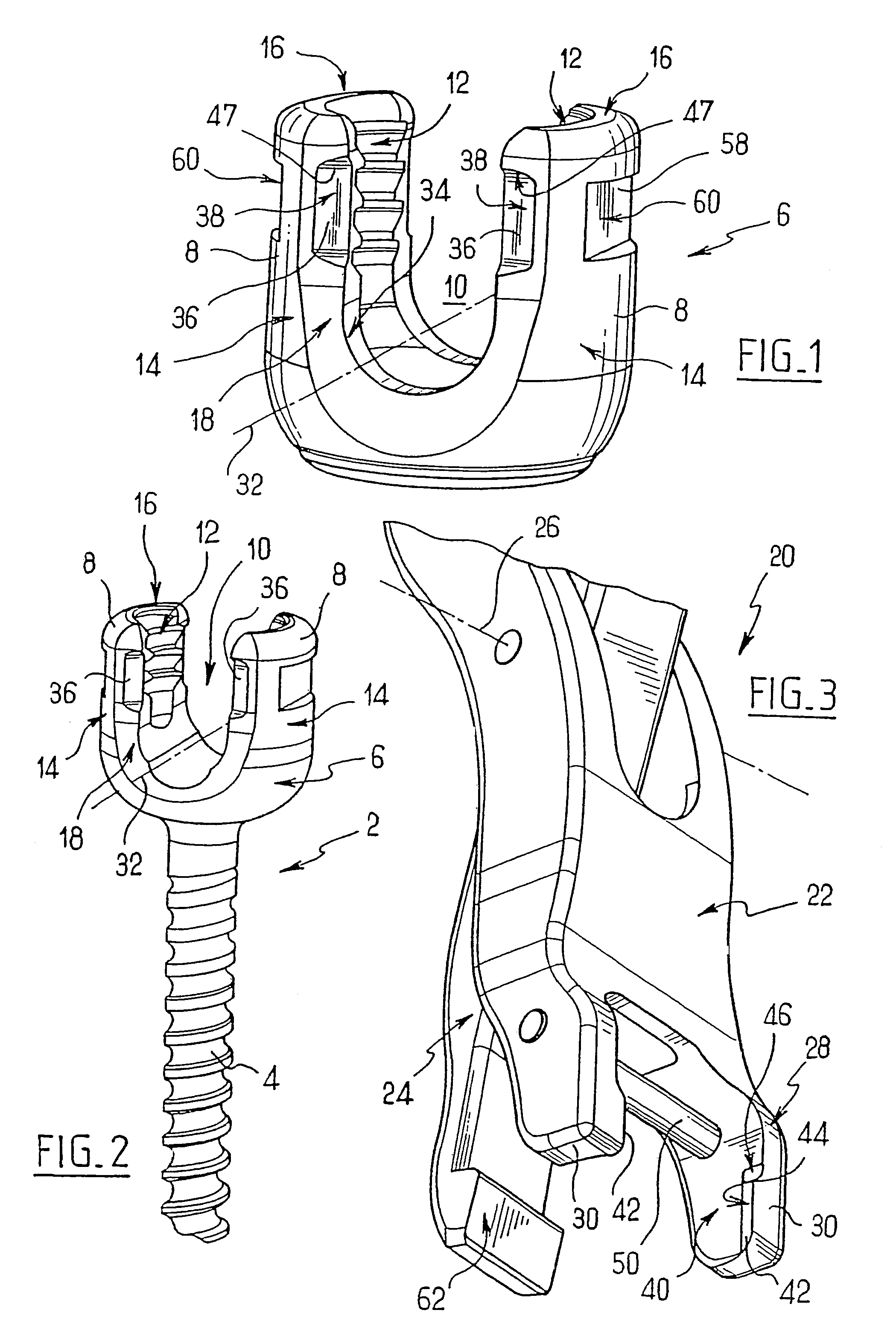 Spinal osteosynthesis assembly comprising the head of an anchoring member and a tool for fixing said head