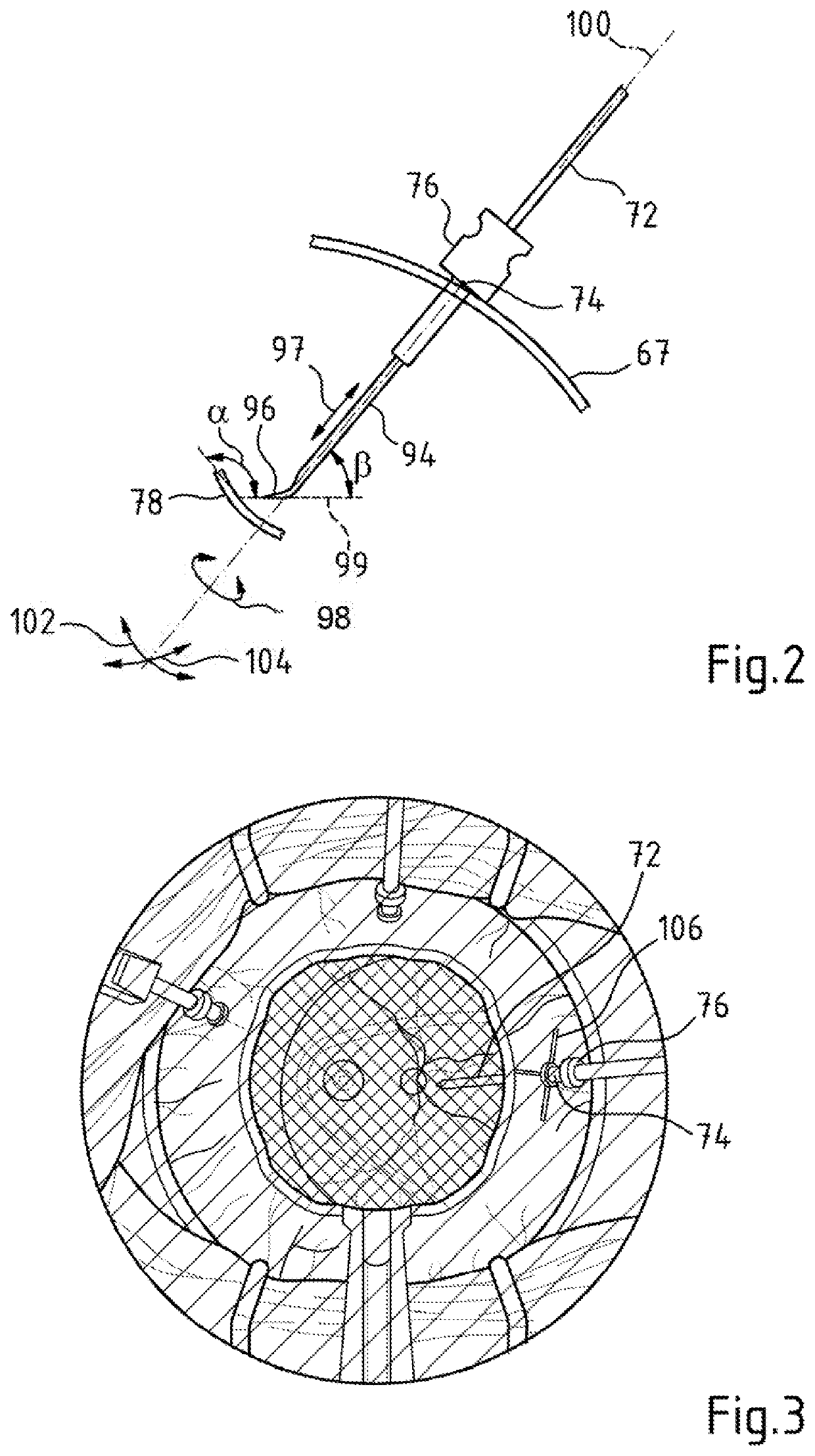 Eye surgery surgical system and computer implemented method for providing the position of at least one trocar point