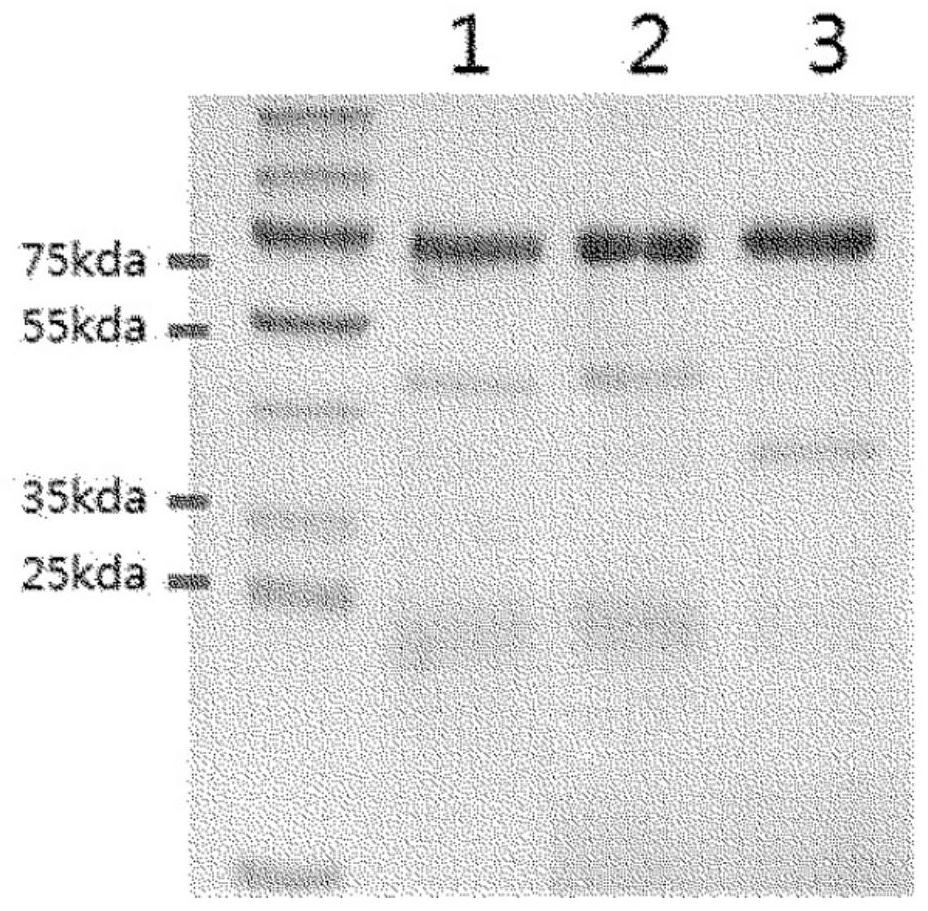 Method for preparing Anti-helicobacter pylori egg yolk antibody
