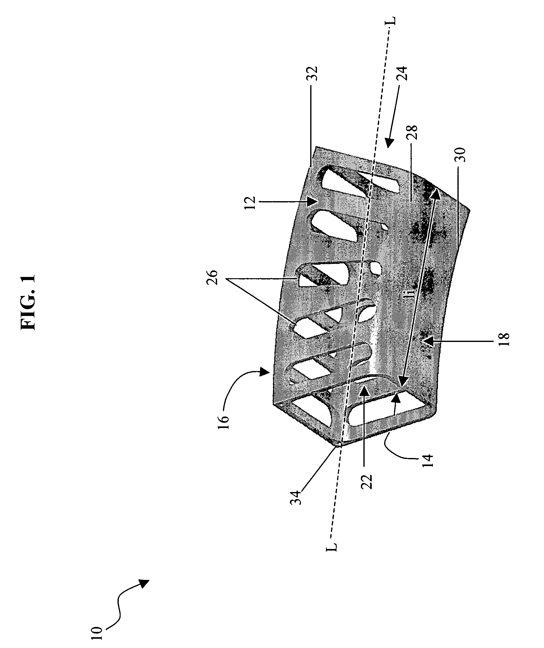 Method for implanting a laminoplasty
