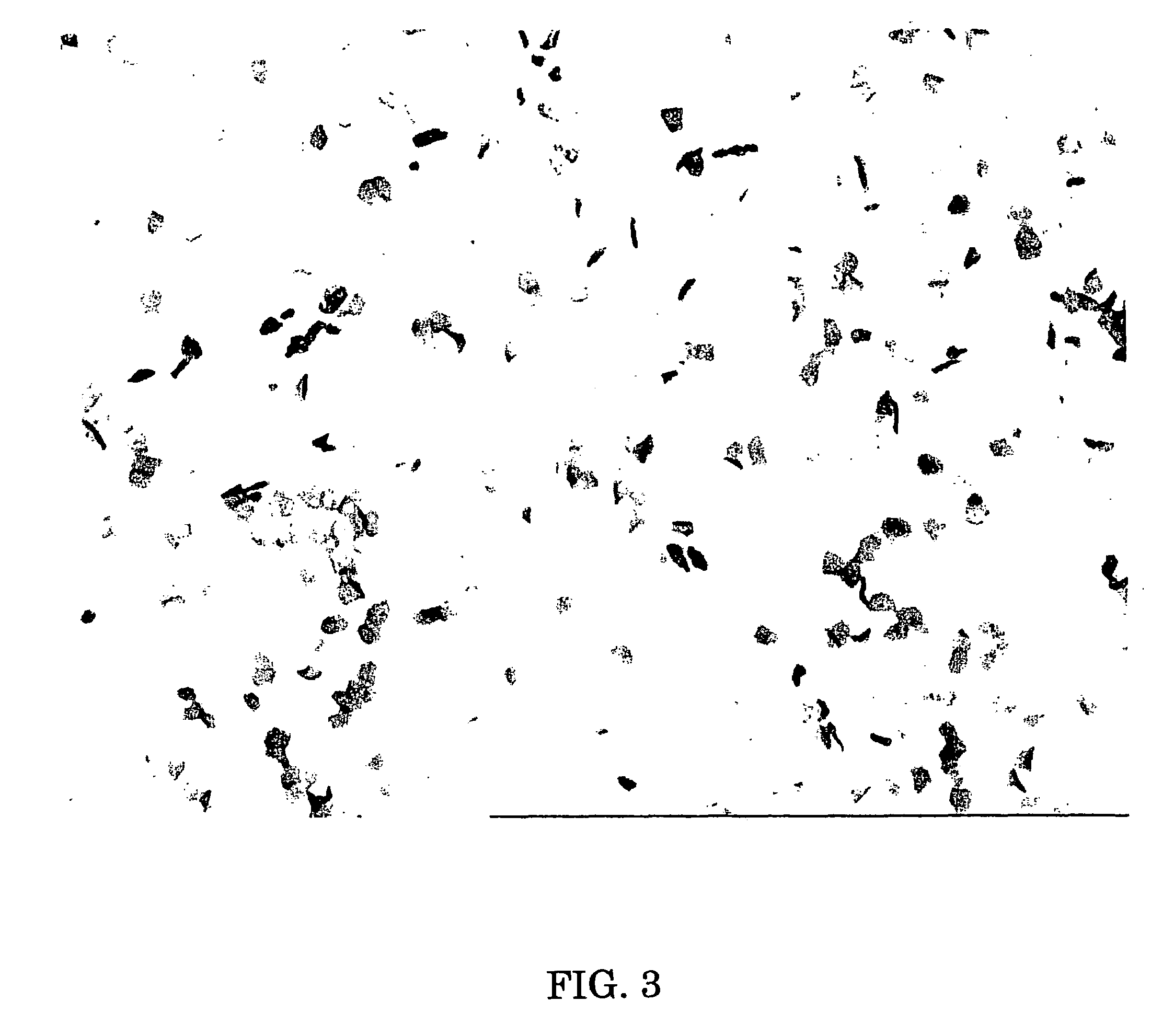 Method for staining corneocytes, method for preparing corneocytes specimen and skin analysis system