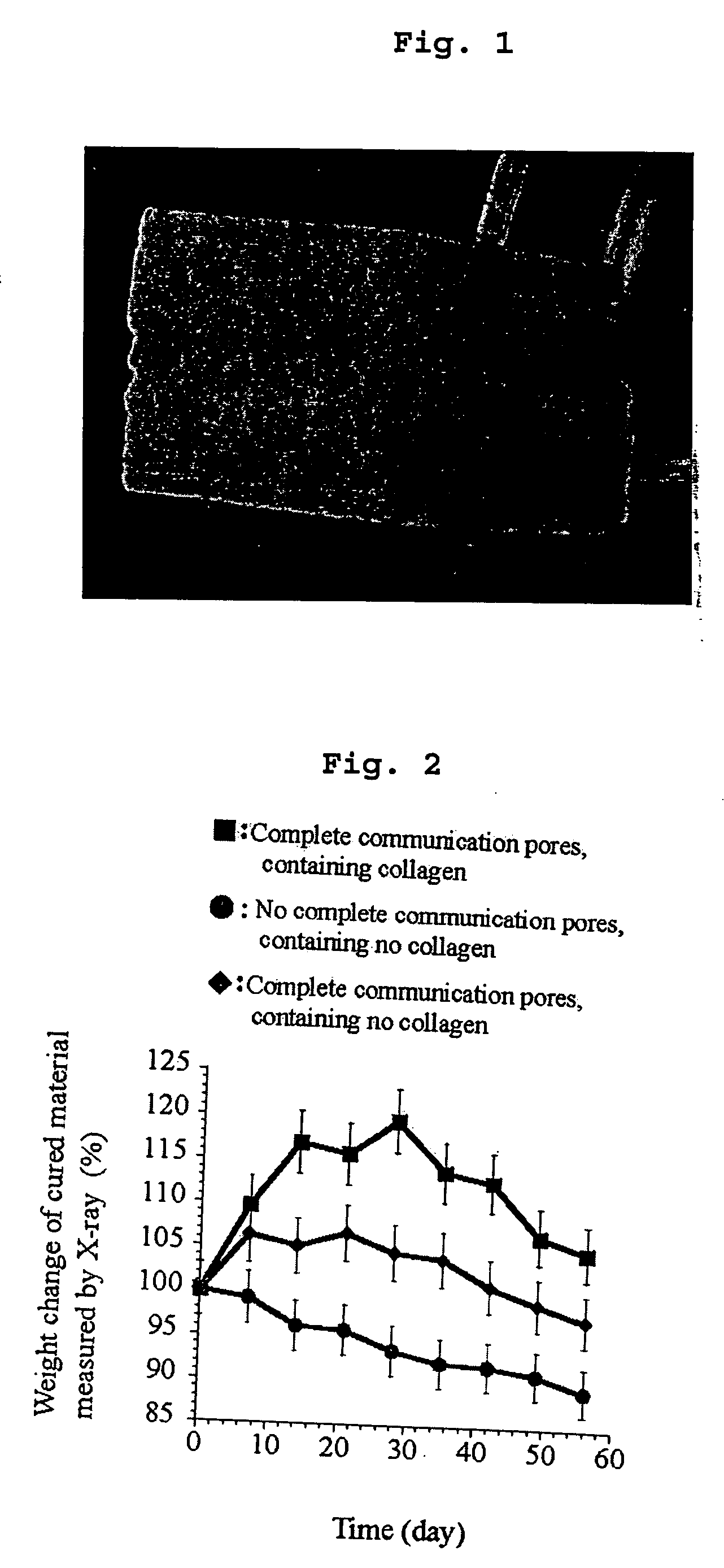 Cured porous calcium phosphate material and uses thereof