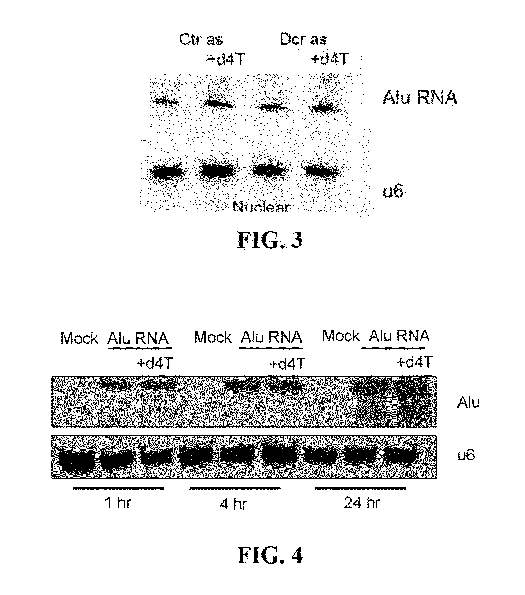 Compositions and methods for treating retinal degradation