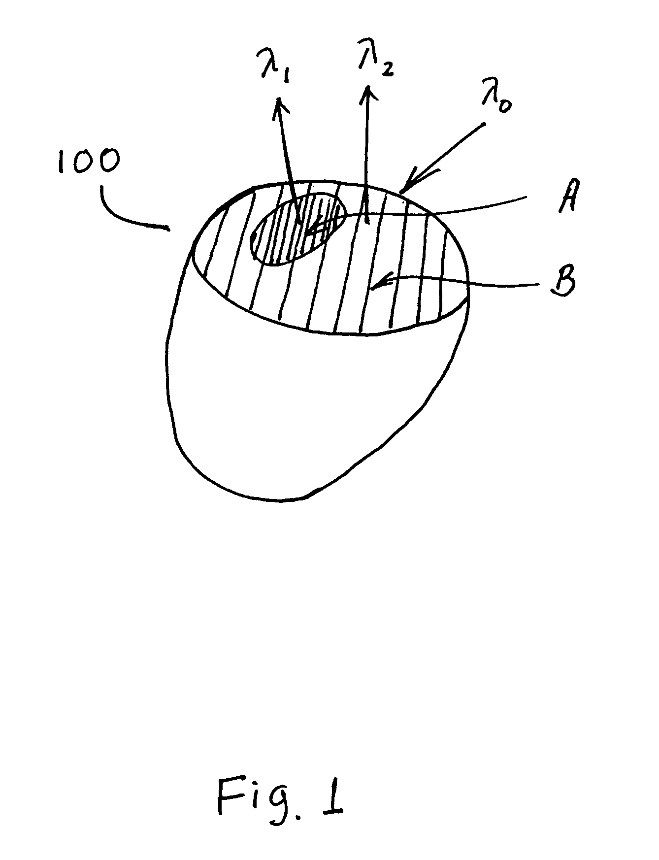Apparatus and methods of detection of radiation injury using optical spectroscopy