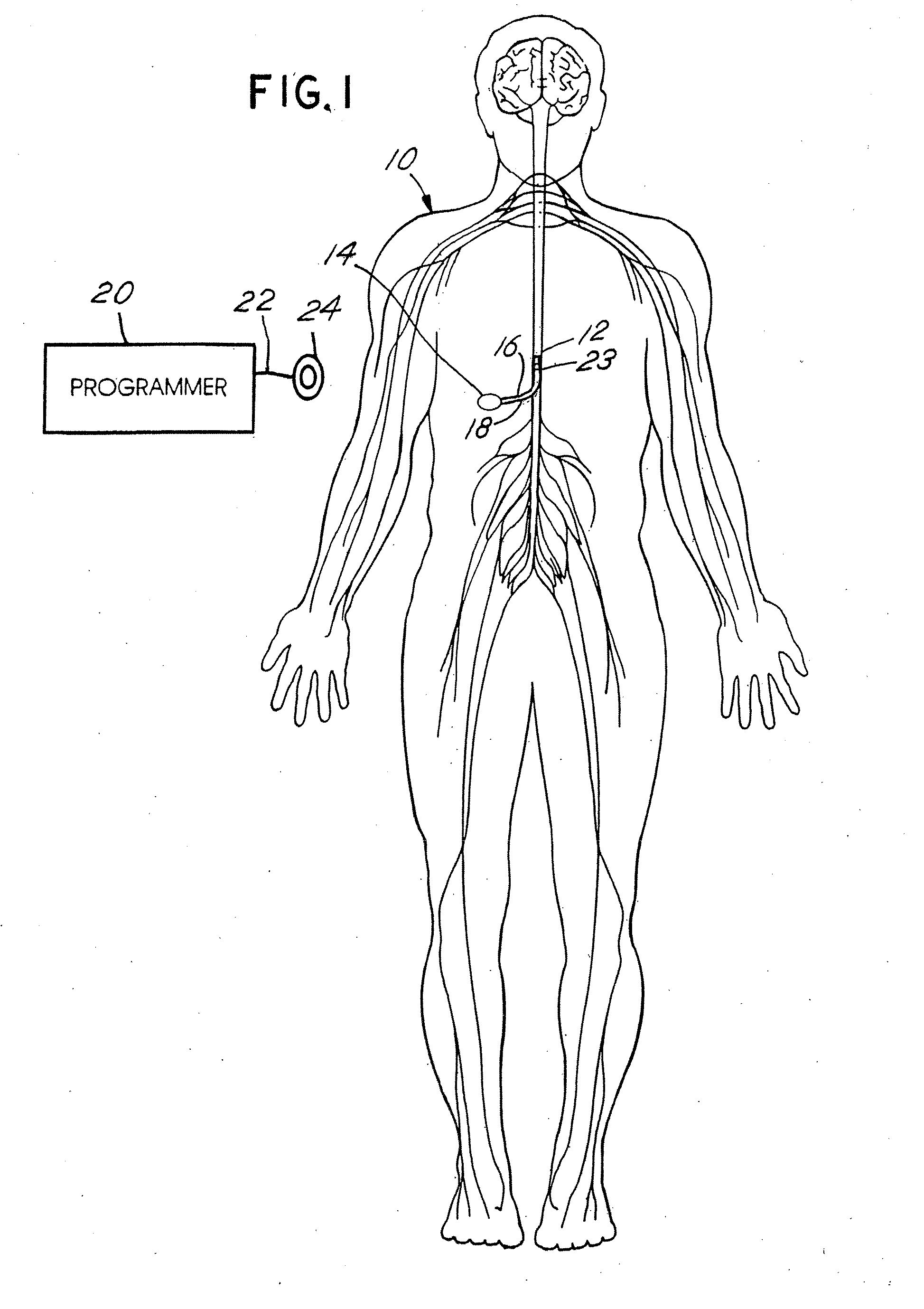 Techniques for positioning therapy delivery elements within a spinal cord or brain