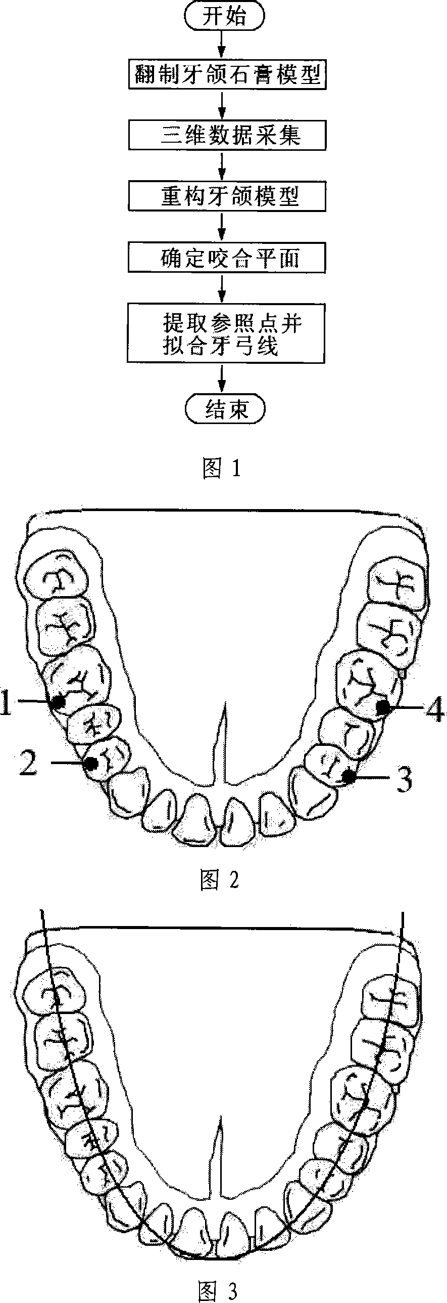 Method for fast and accurately detecting dental arch line on three-dimension grid dental cast