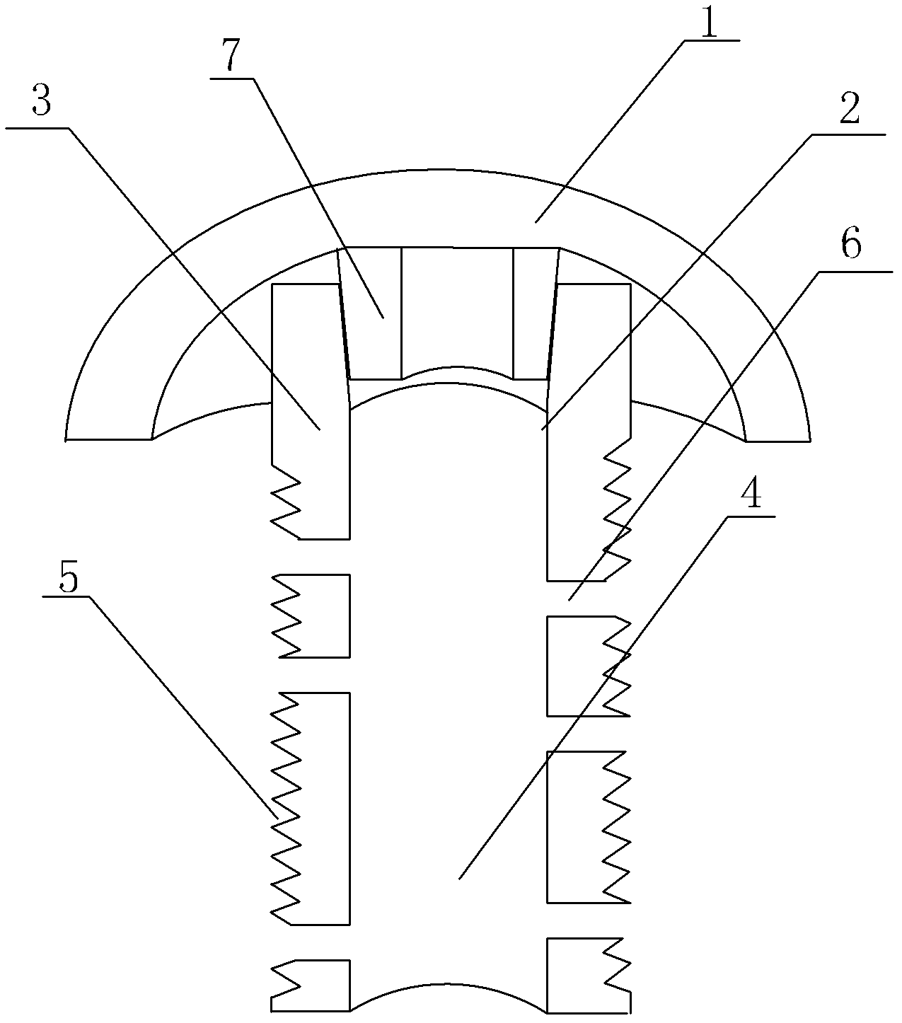 Biotype femoral head surface substitutive prosthesis